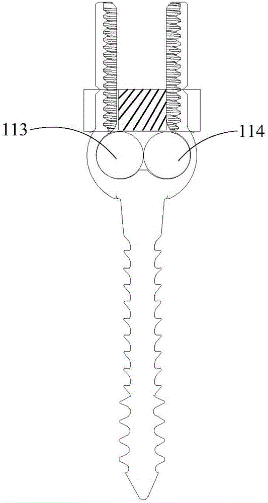 Vertebral pedicle fixator and fixing system