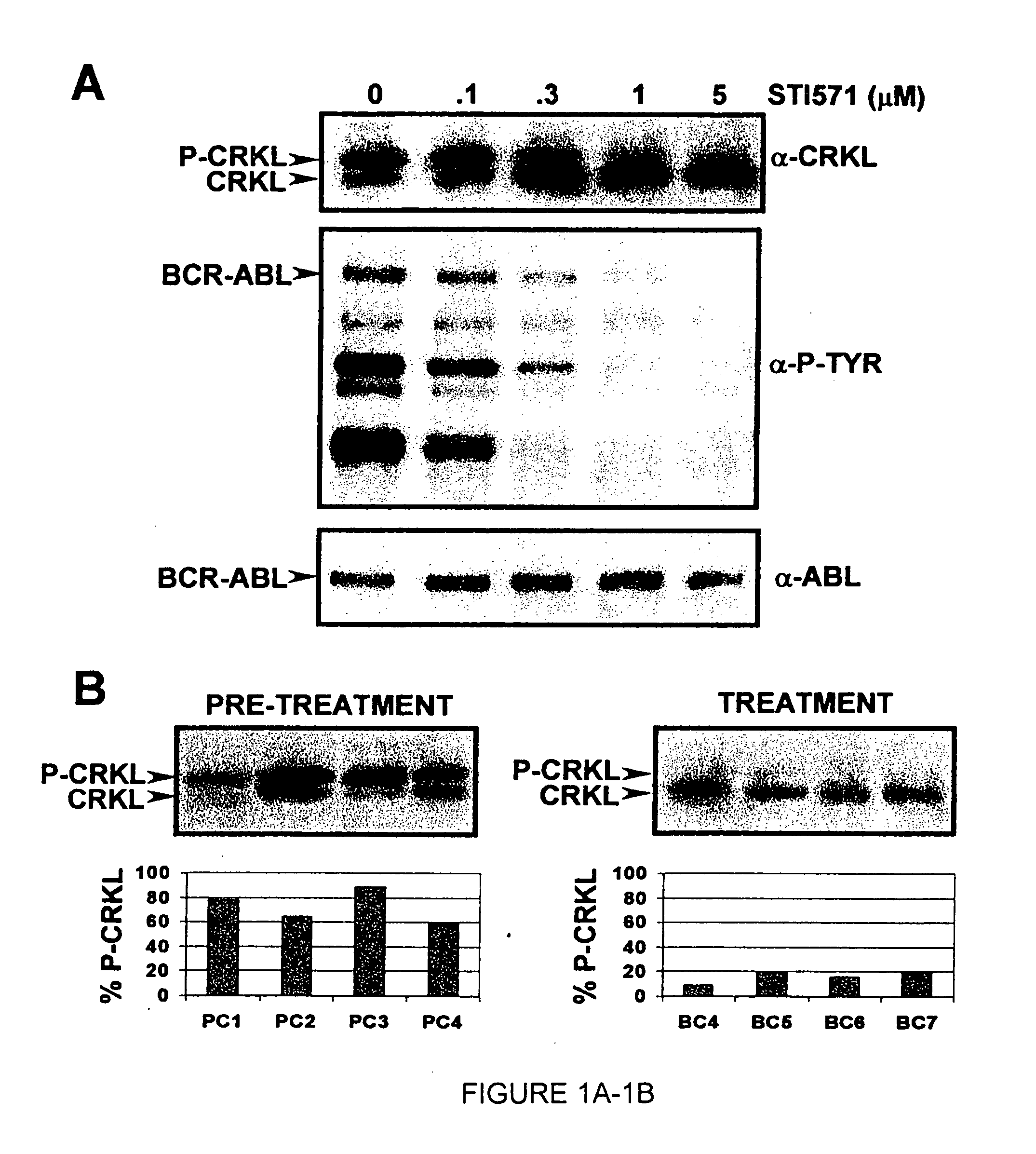 Mutations in the Bcr-Abl tyrosine kinase associated with resistance to STI-571