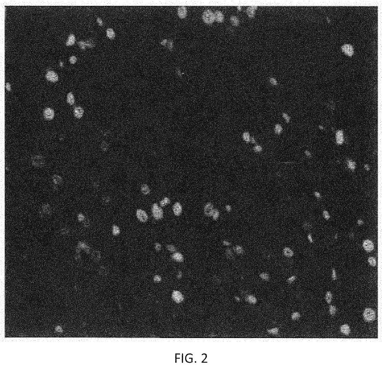 Performing segmentation of cells and nuclei in multi-channel images