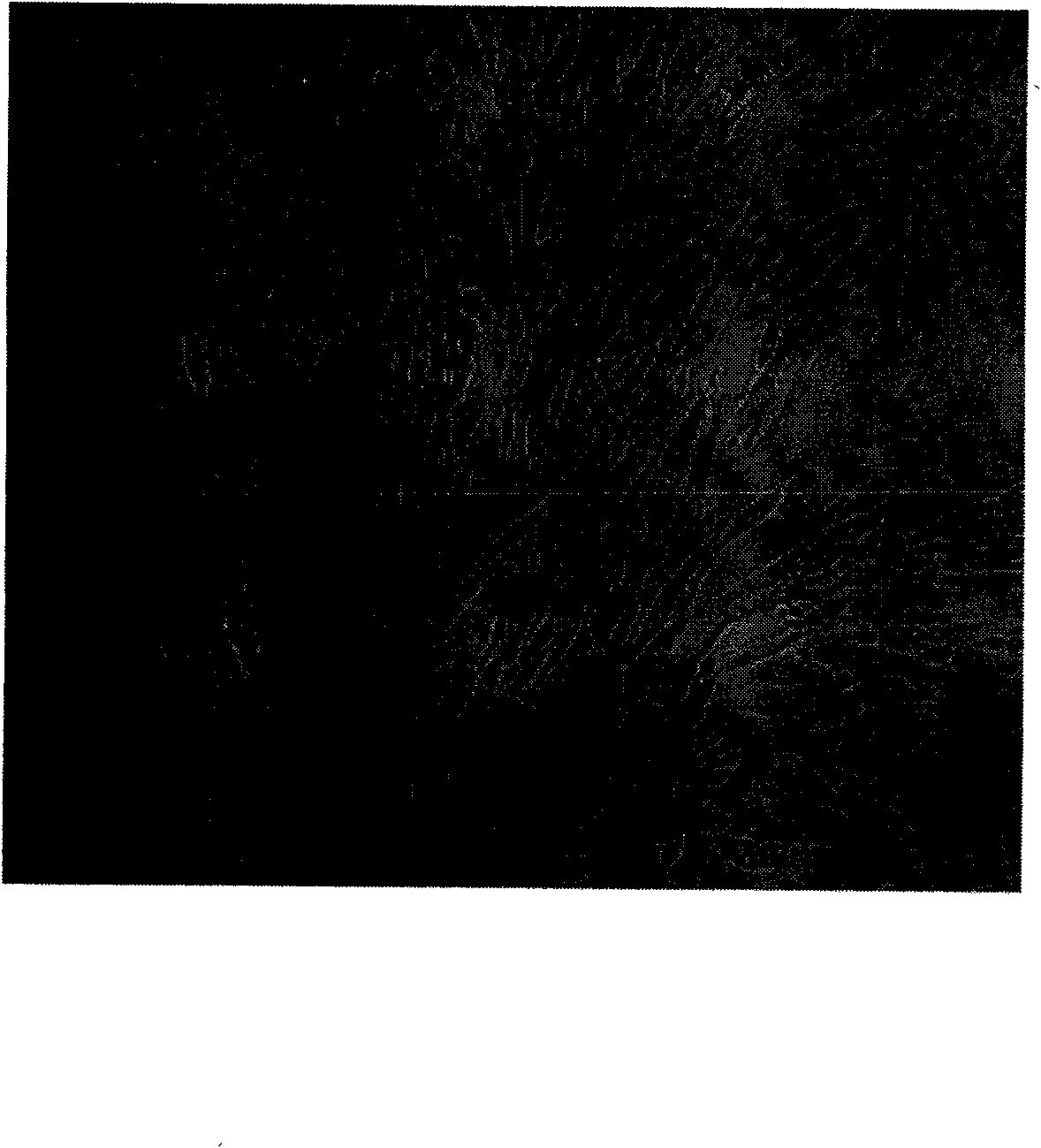 Method for culturing autologous tissue fibroblast