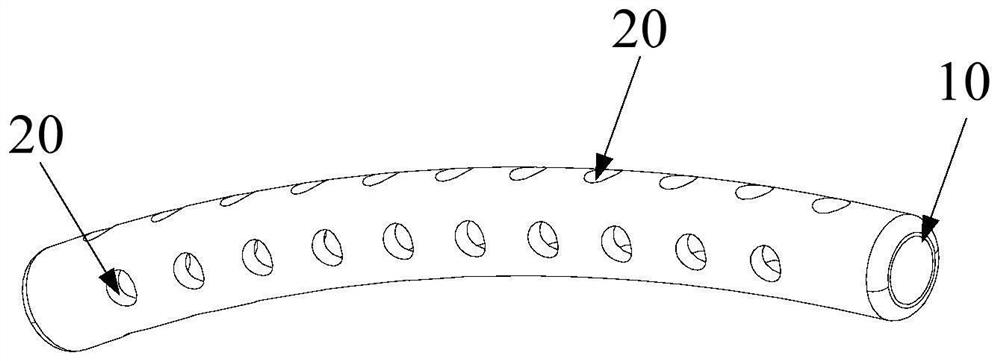 Glaucoma drainage device and glaucoma drainage implant