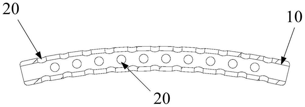 Glaucoma drainage device and glaucoma drainage implant