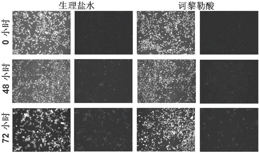 Application of chebulagic acid in preparation of medicament for treating diseases resulted from human enterovirus type 71 infection