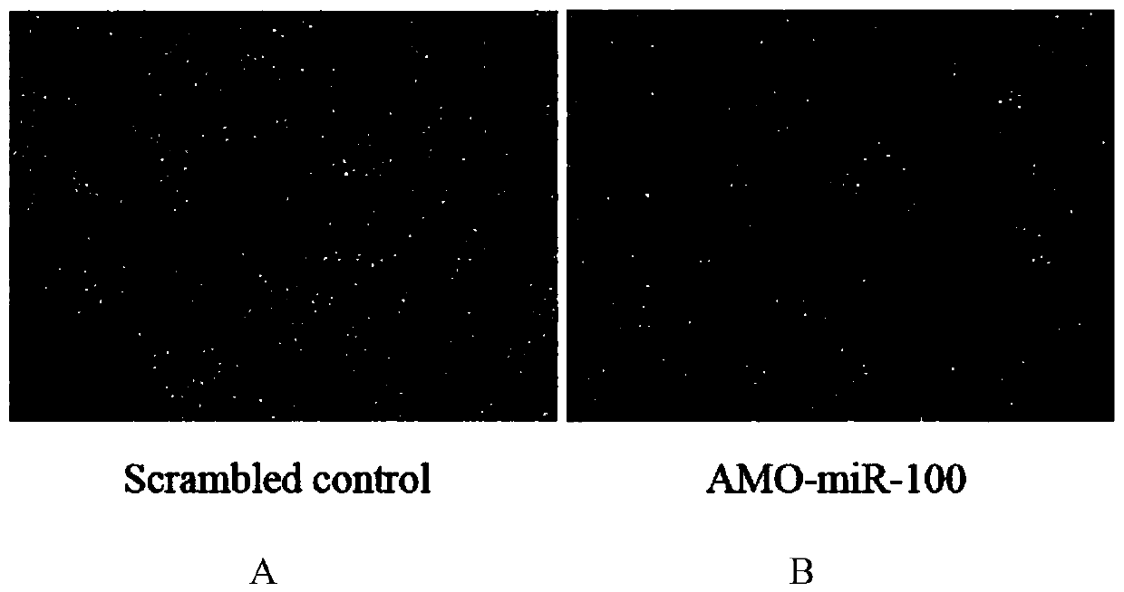 Application of a kind of mir-100 inhibitor in preparation of medicine for treating breast cancer