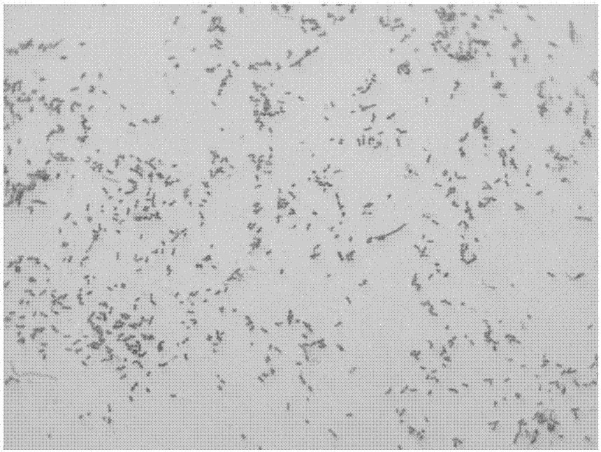 Infectious actinobacillus pleuropneumoniae and application thereof