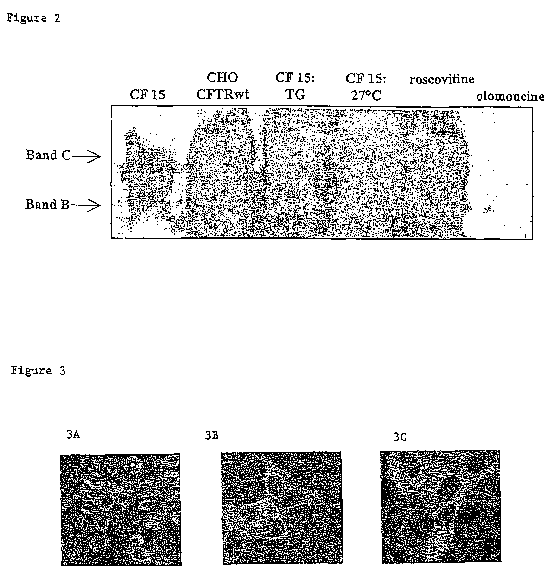 Use of purine derivatives for the production of medicaments for the treatment of mucoviscidosis and diseases related to protein addressing errors in cells