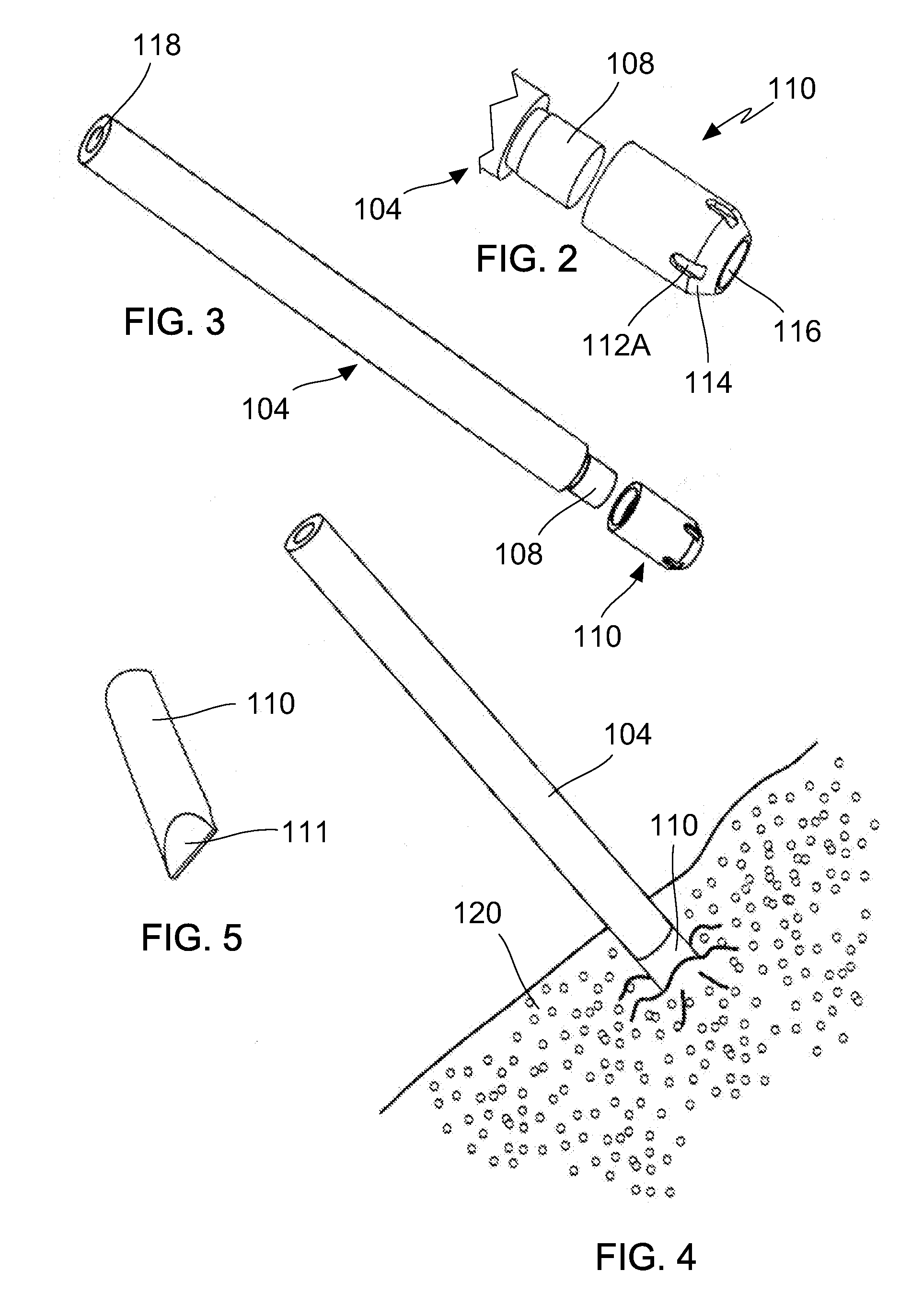 Methods and devices for utilizing bondable materials