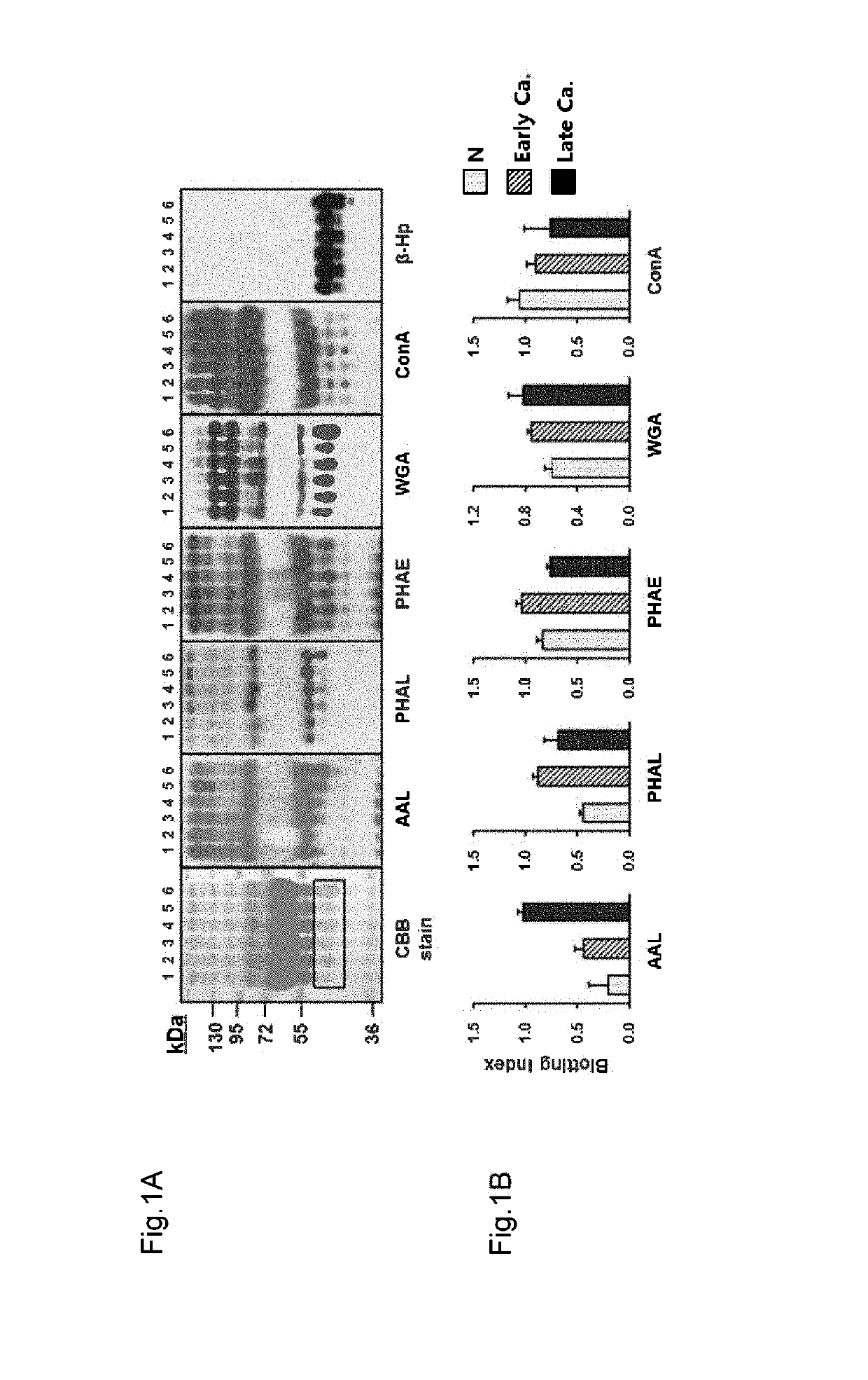 Diagnostic method for gastric cancer