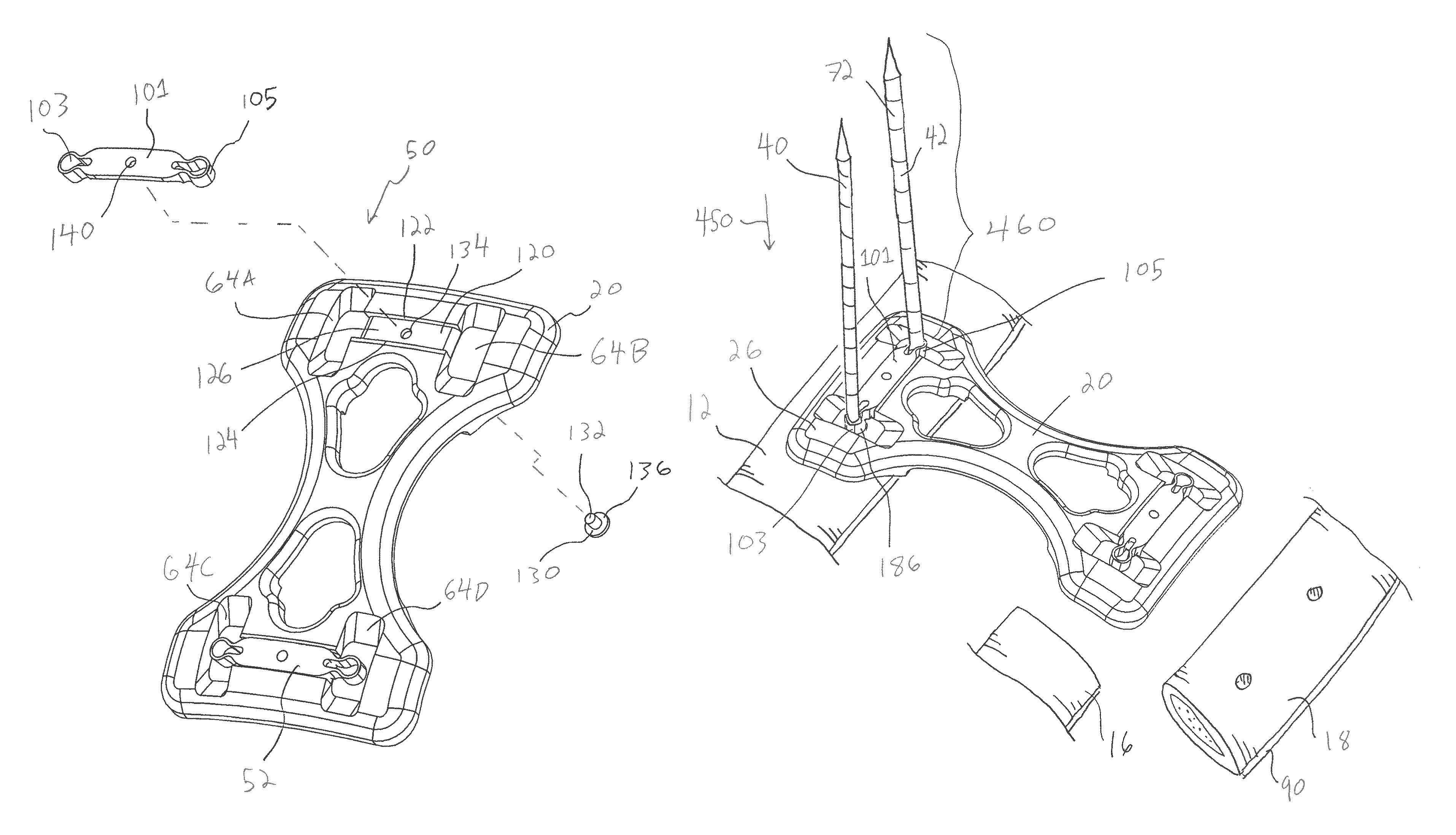 Bone plate system and method