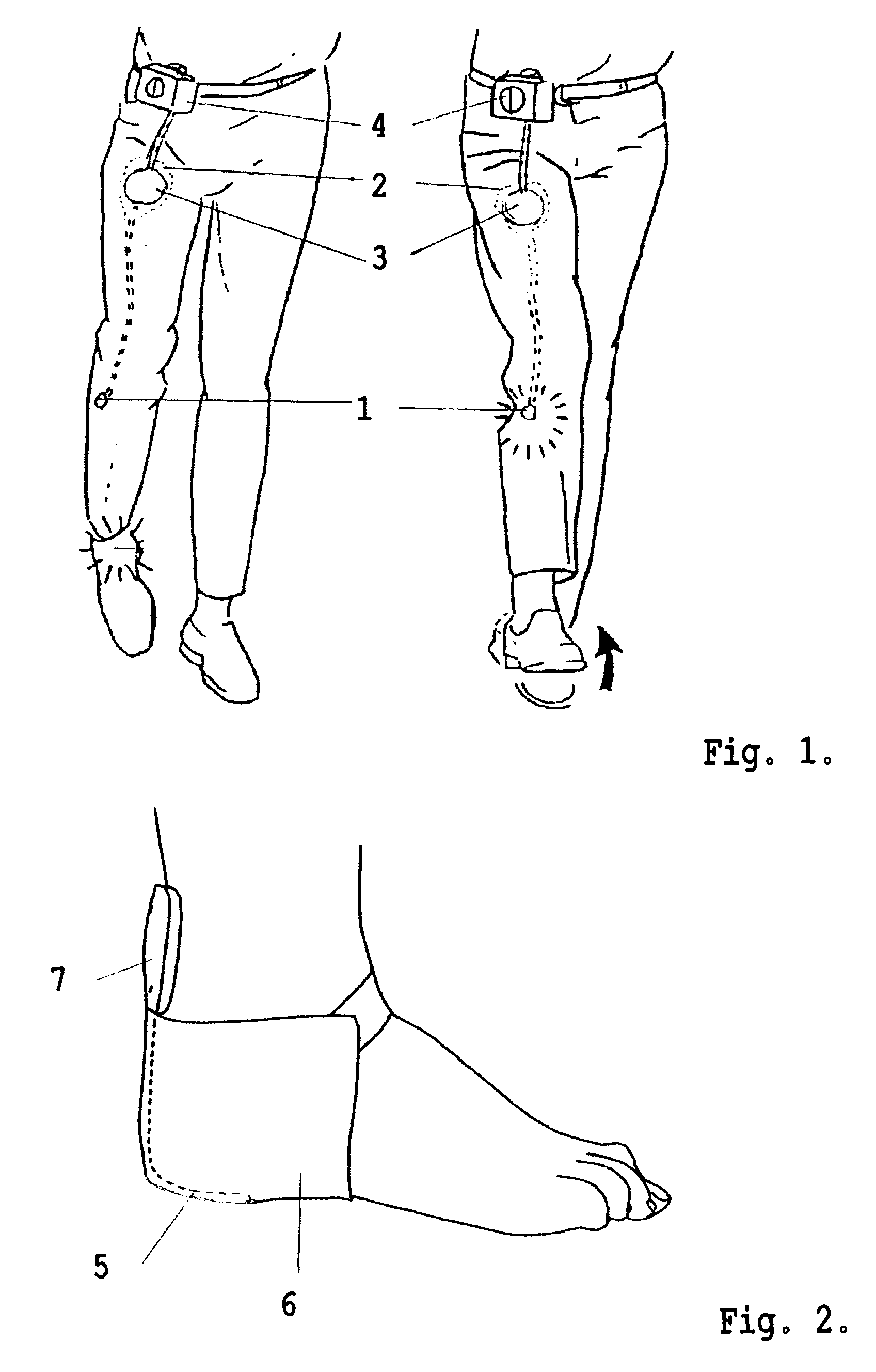 System for electrical stimulation of nerves