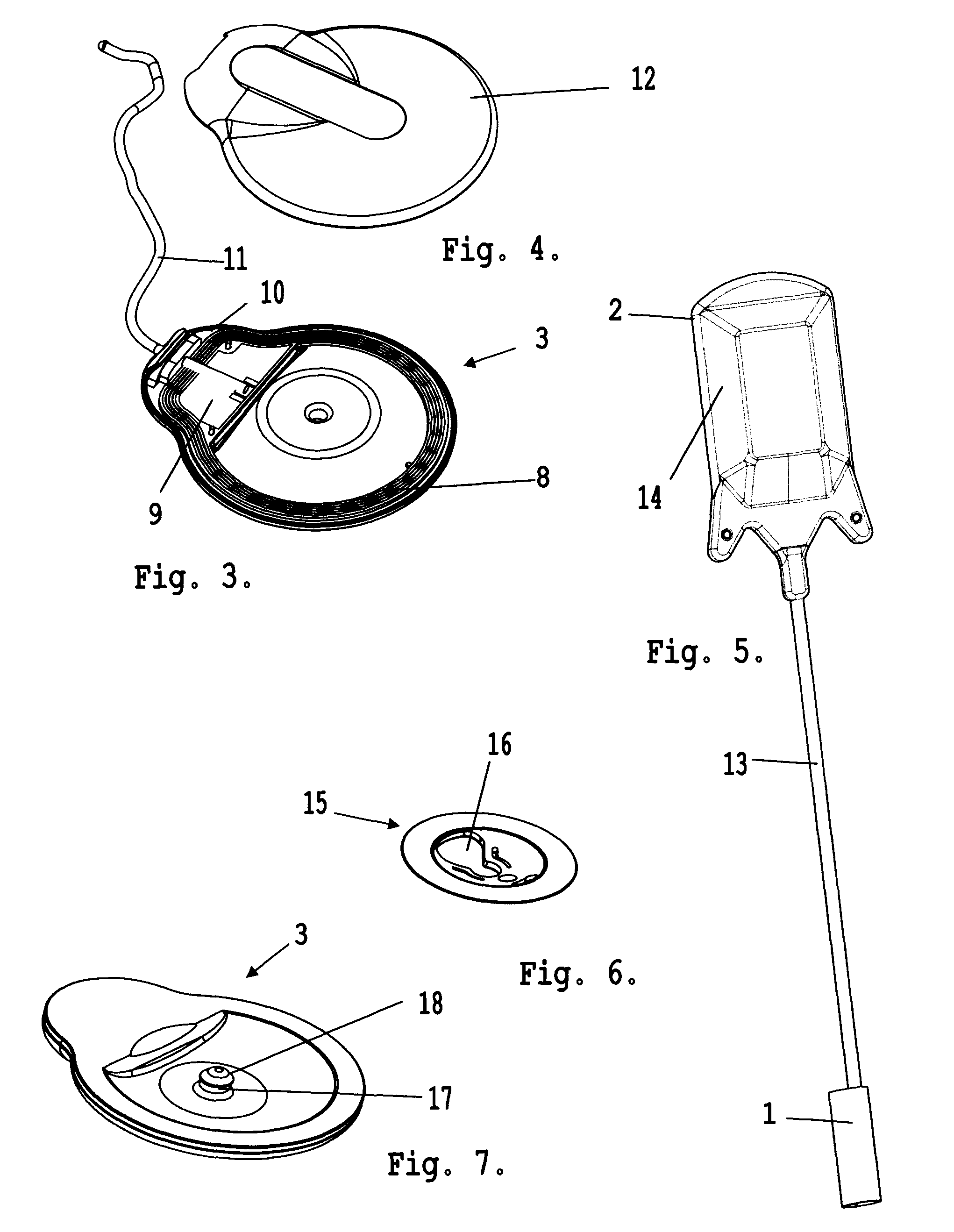 System for electrical stimulation of nerves