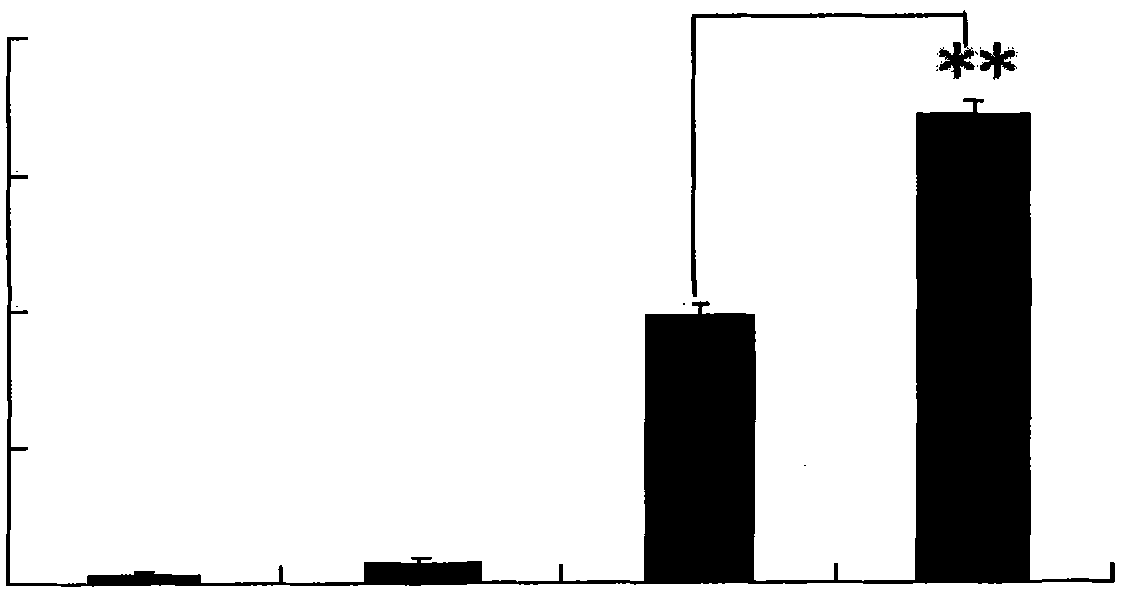 Application of lariciresinol to preparing medicament for resisting autoimmune disease and graft rejection disease