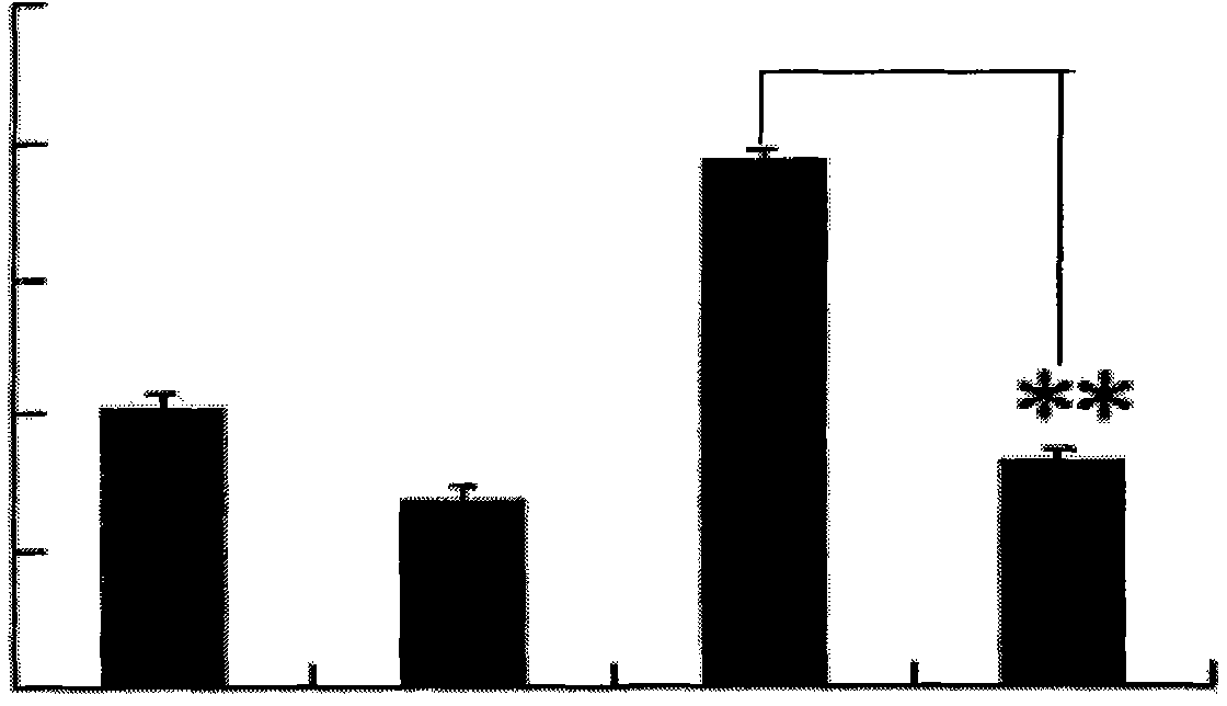 Application of lariciresinol to preparing medicament for resisting autoimmune disease and graft rejection disease