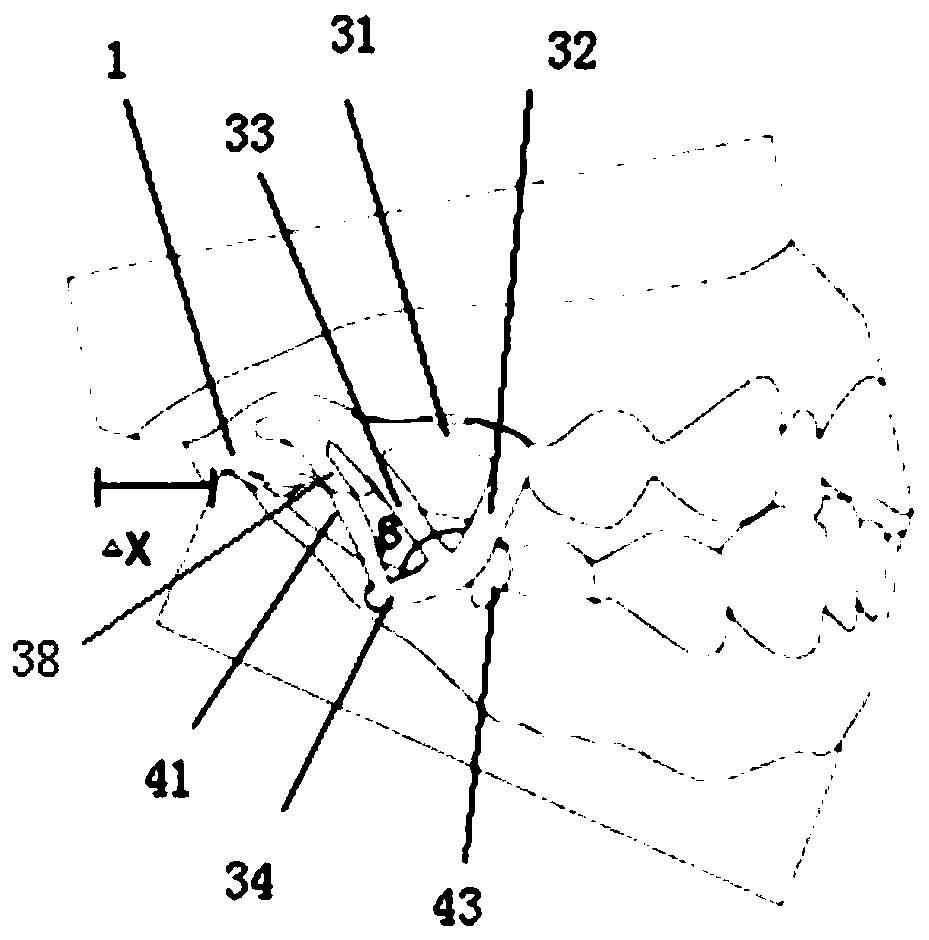 Personalized customized fixed-function appliance for mandibular protrusion