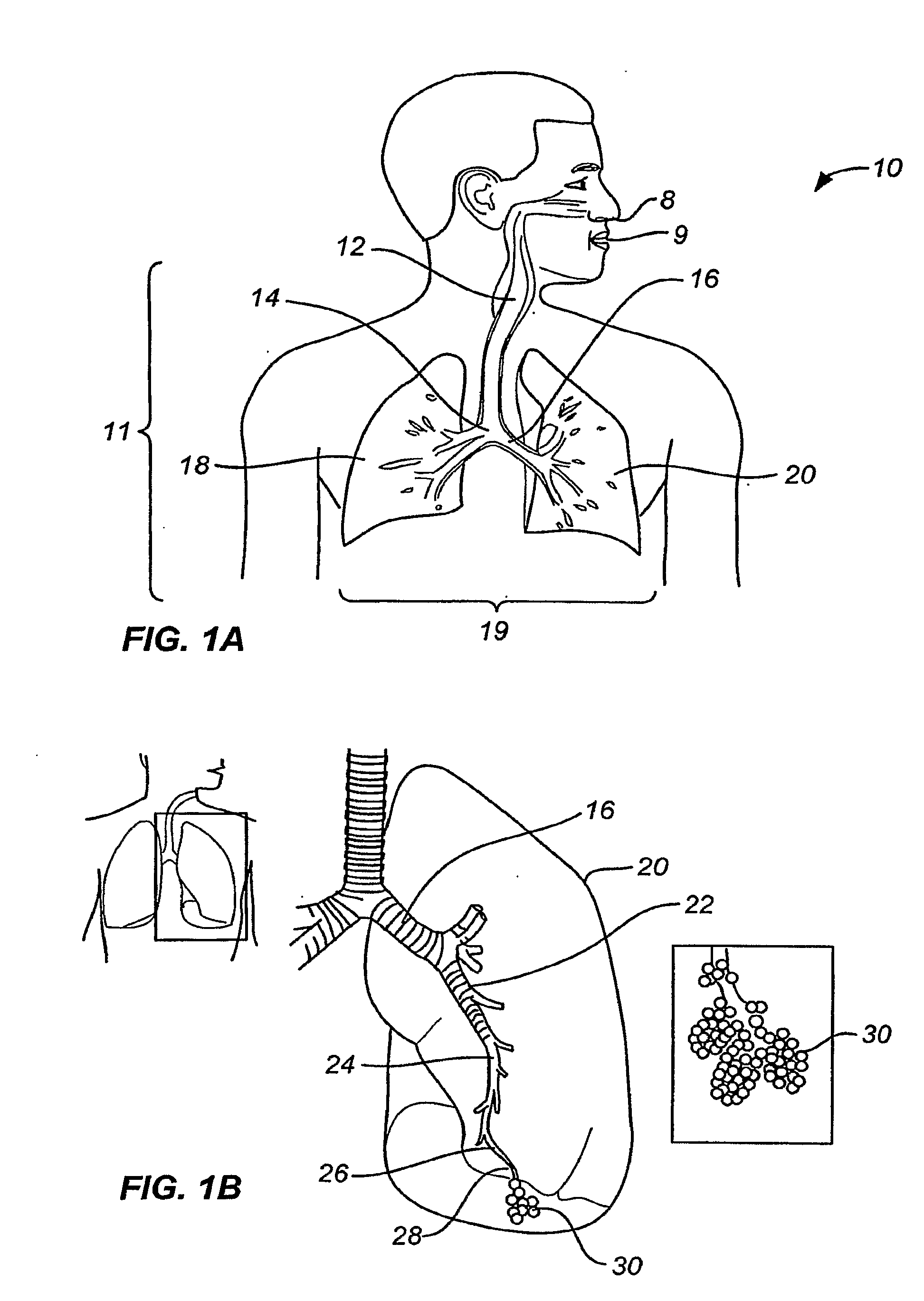 Minimally invasive lung volume reduction devices, methods, and systems