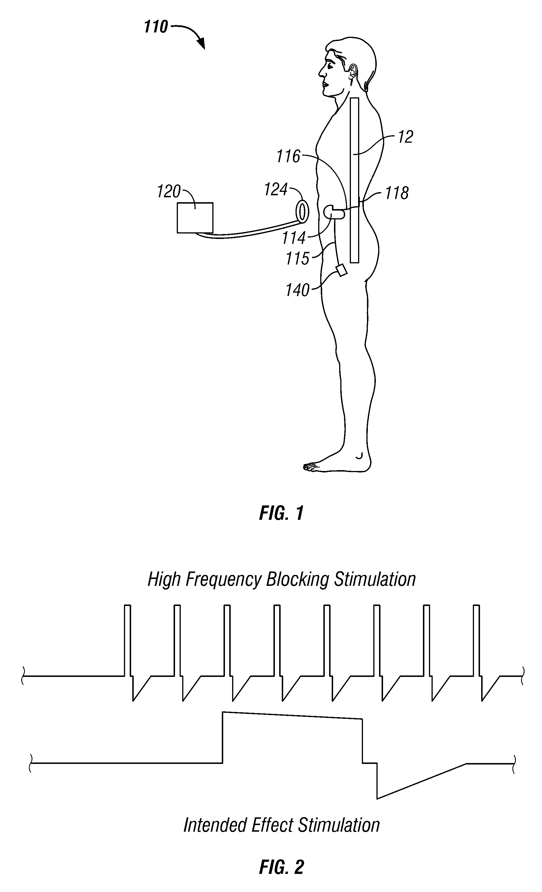 Method For Blocking Activation Of Tissue Or Conduction Of Action Potentials While Other Tissue Is Being Therapeutically Activated