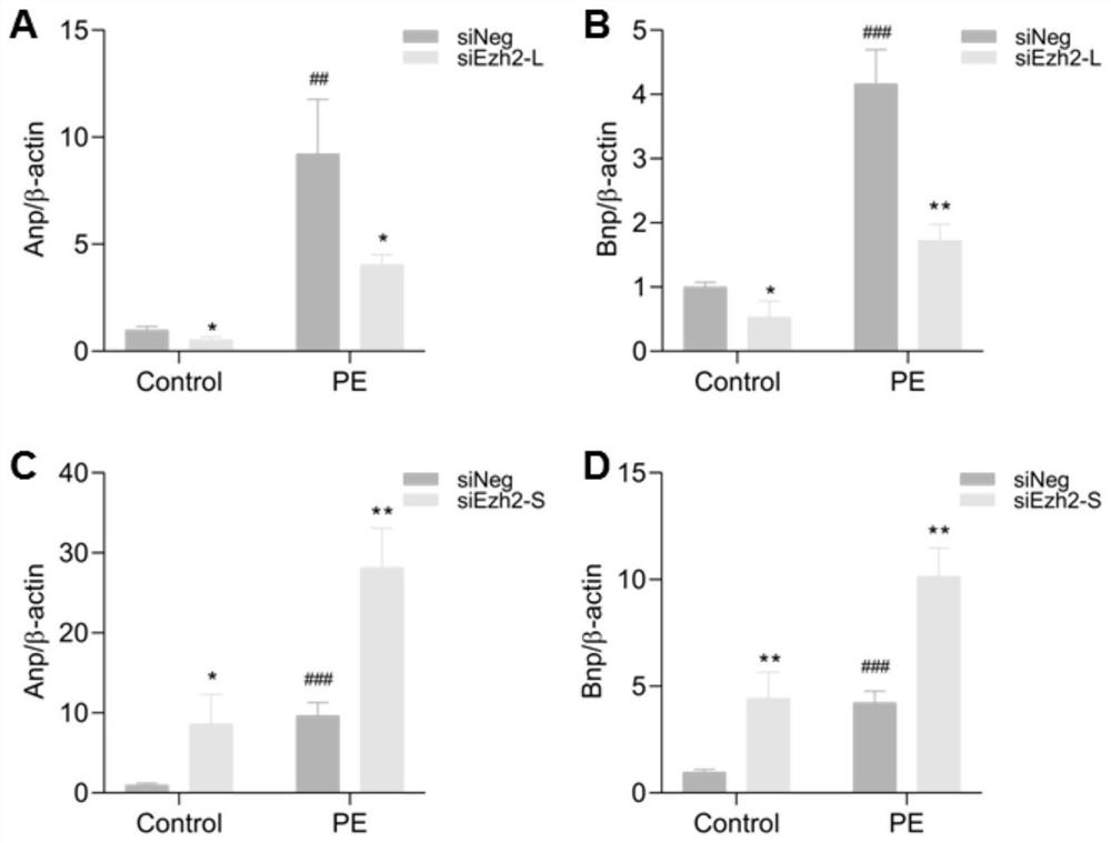 EZH2 variable spliceosome and application thereof