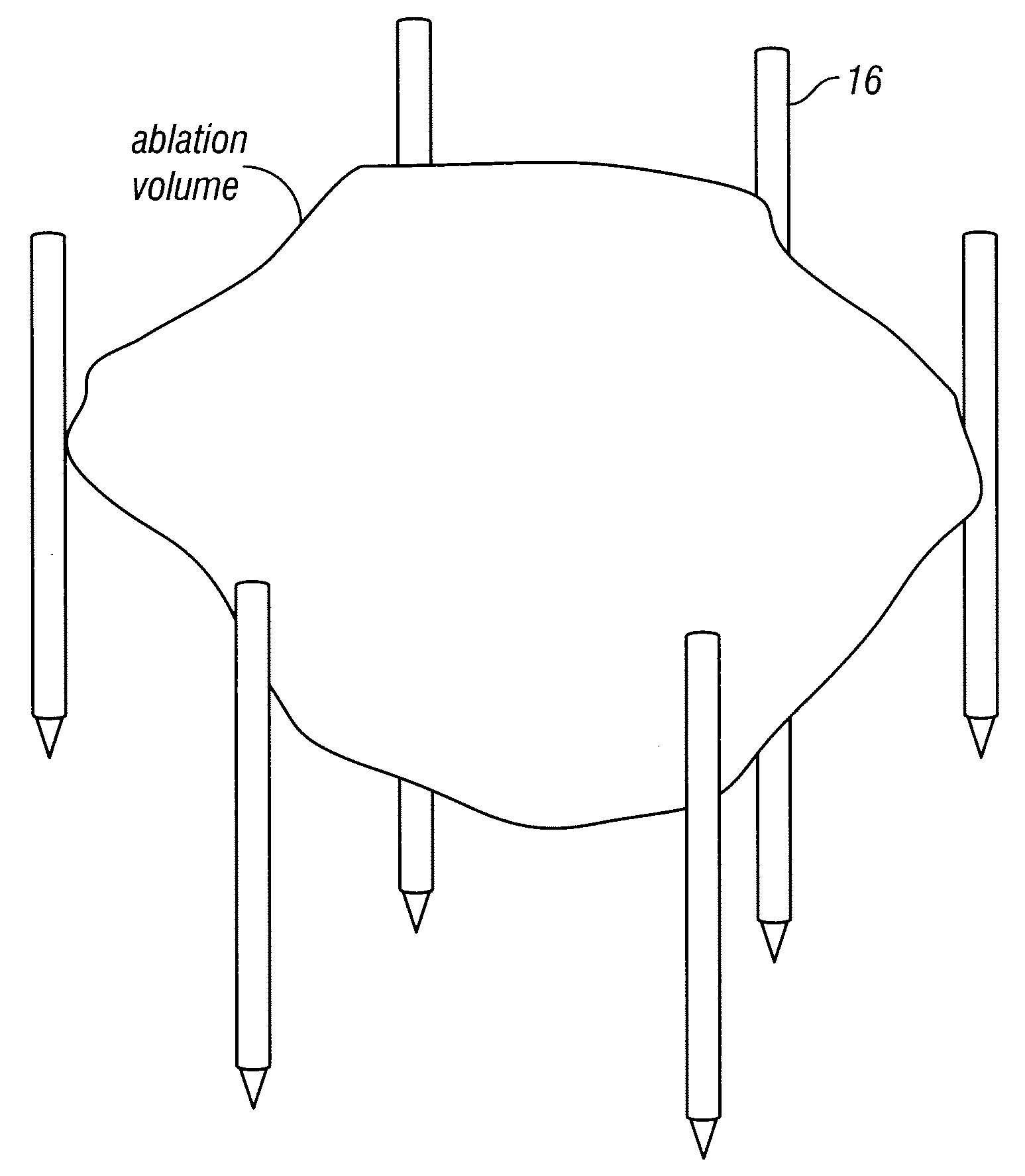 Methods for treating tissue sites using electroporation