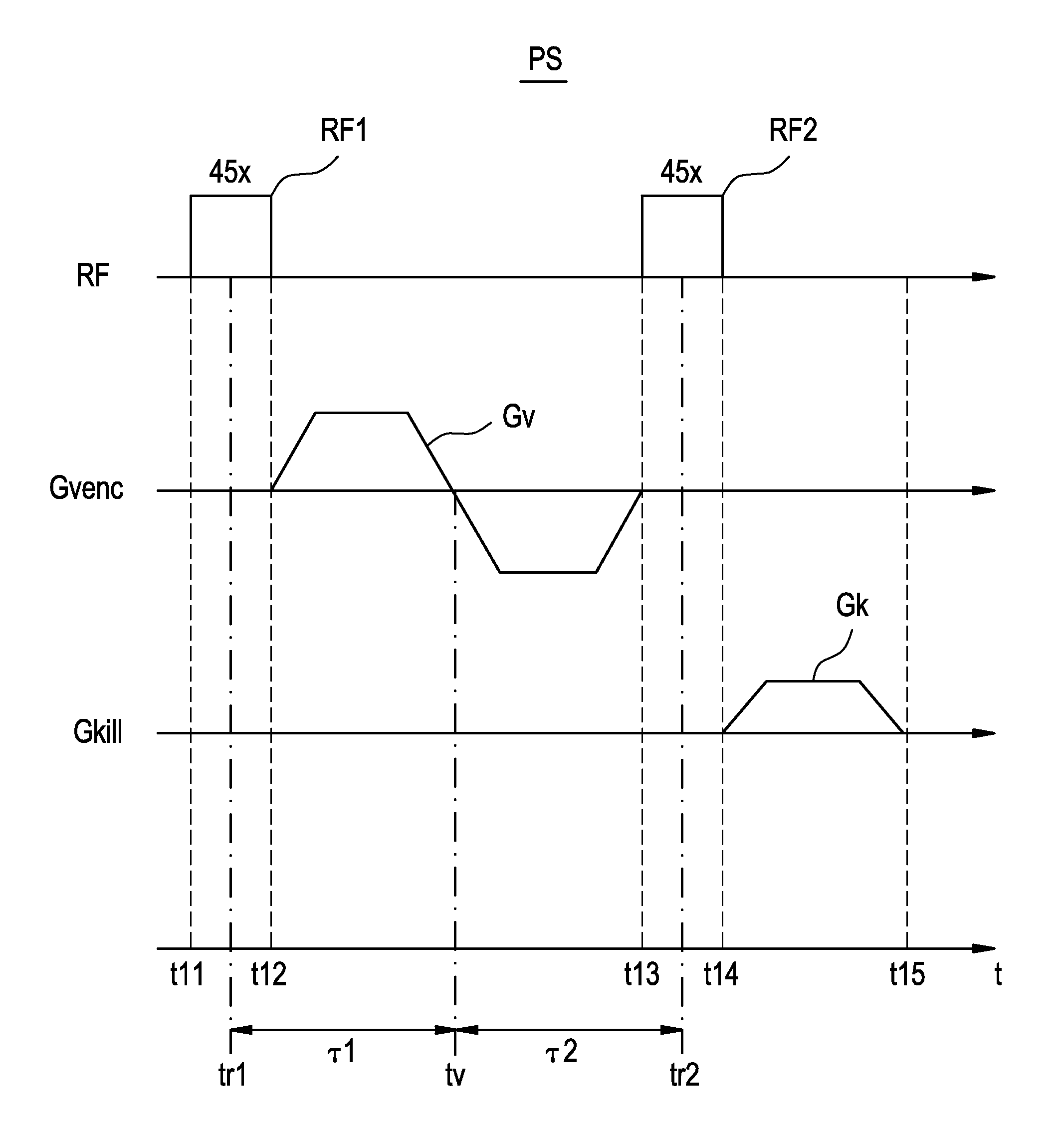 Magnetic resonance imaging apparatus