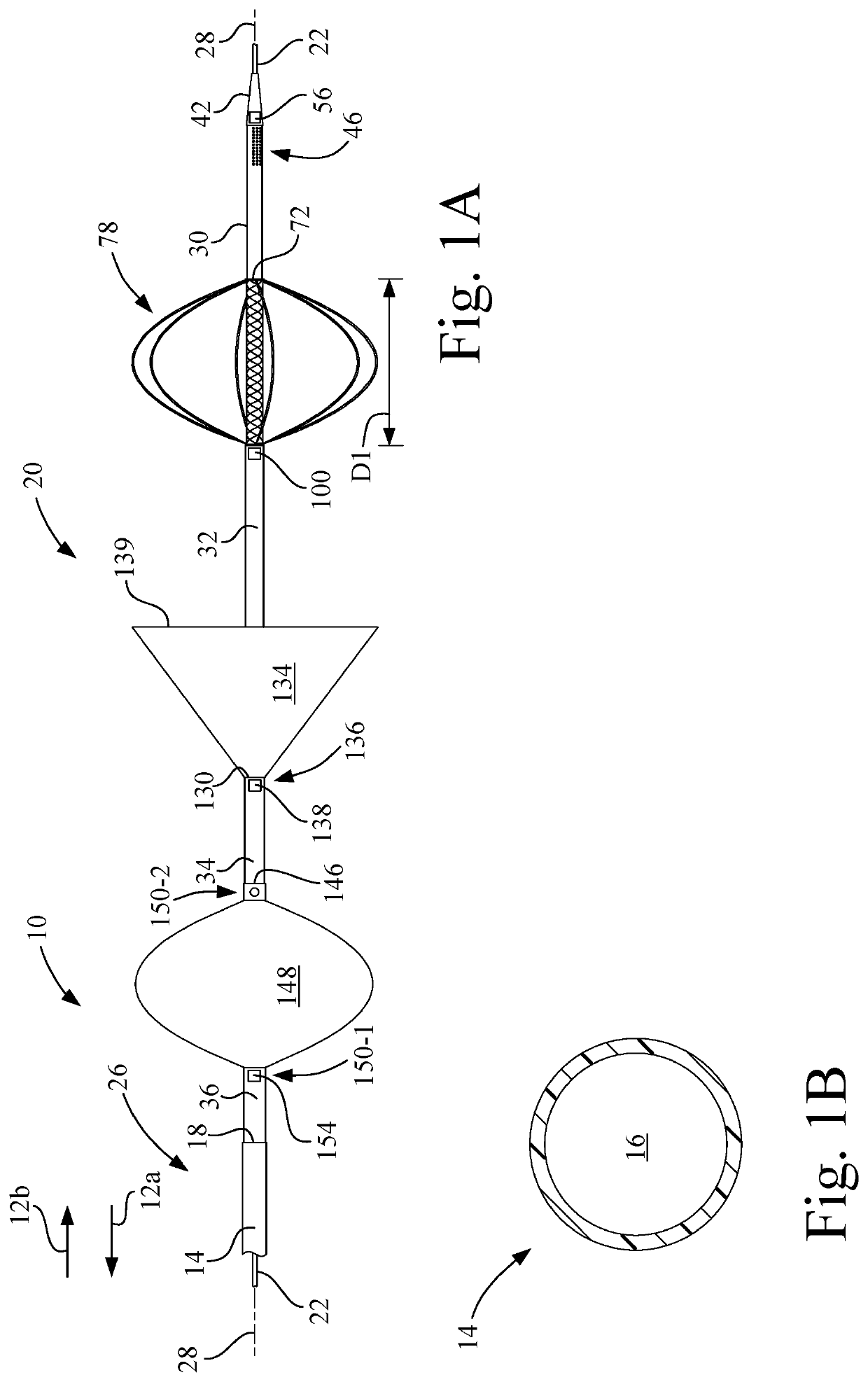 Apparatus and method for treatment of post thrombotic syndrome