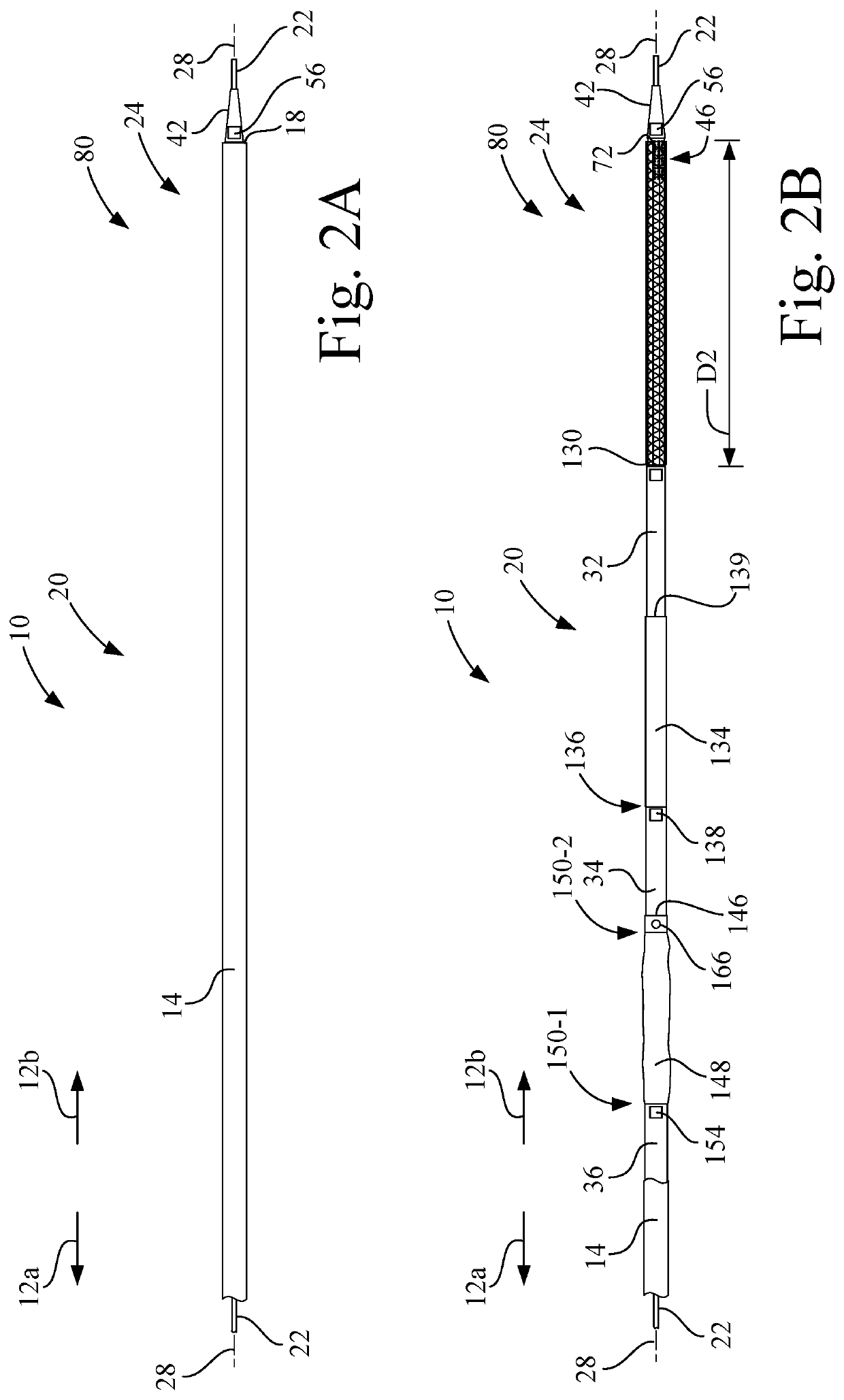 Apparatus and method for treatment of post thrombotic syndrome