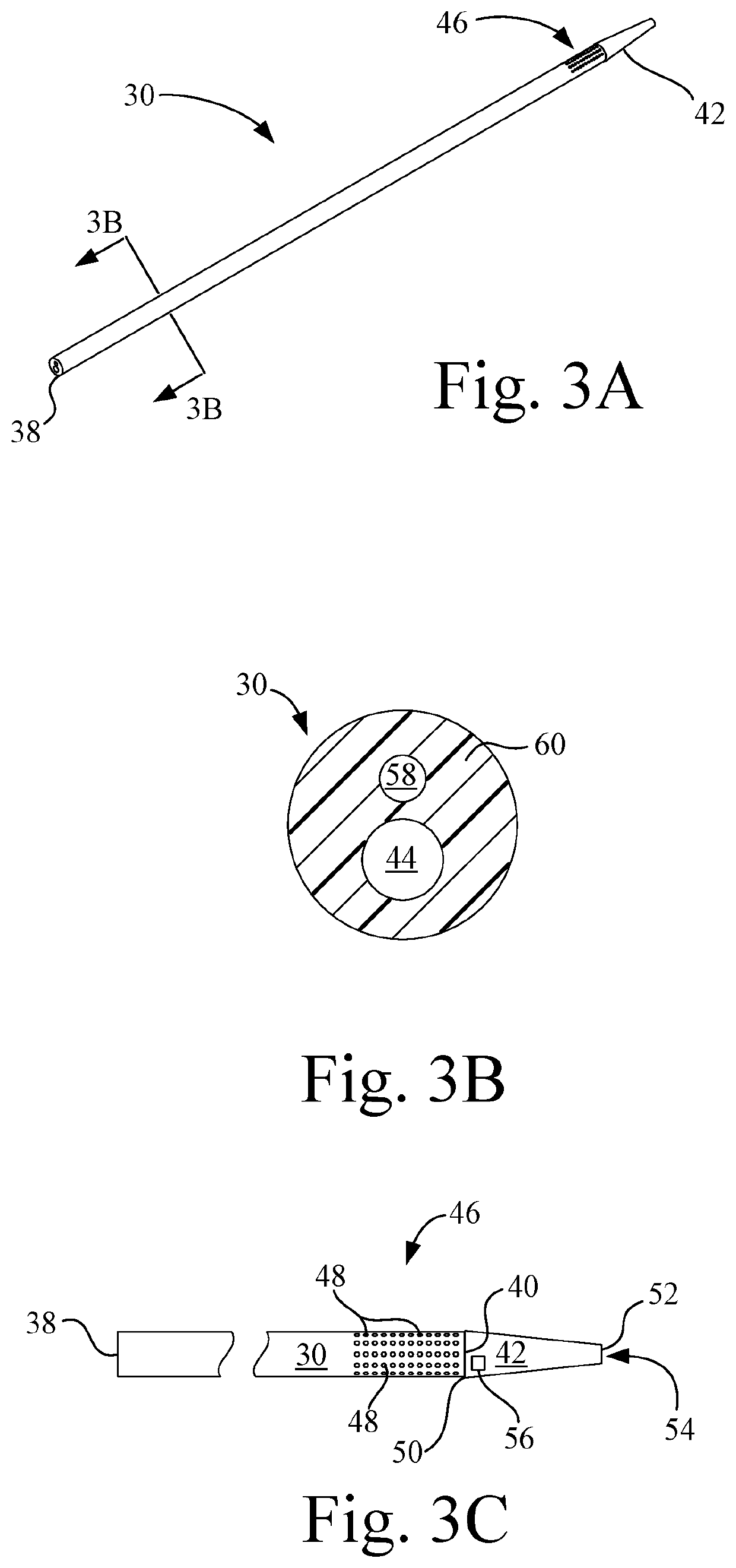 Apparatus and method for treatment of post thrombotic syndrome