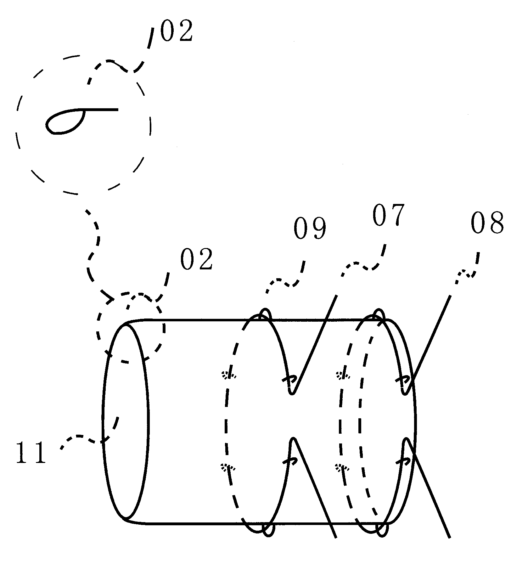 Oversleeve type aorta anastomosis device