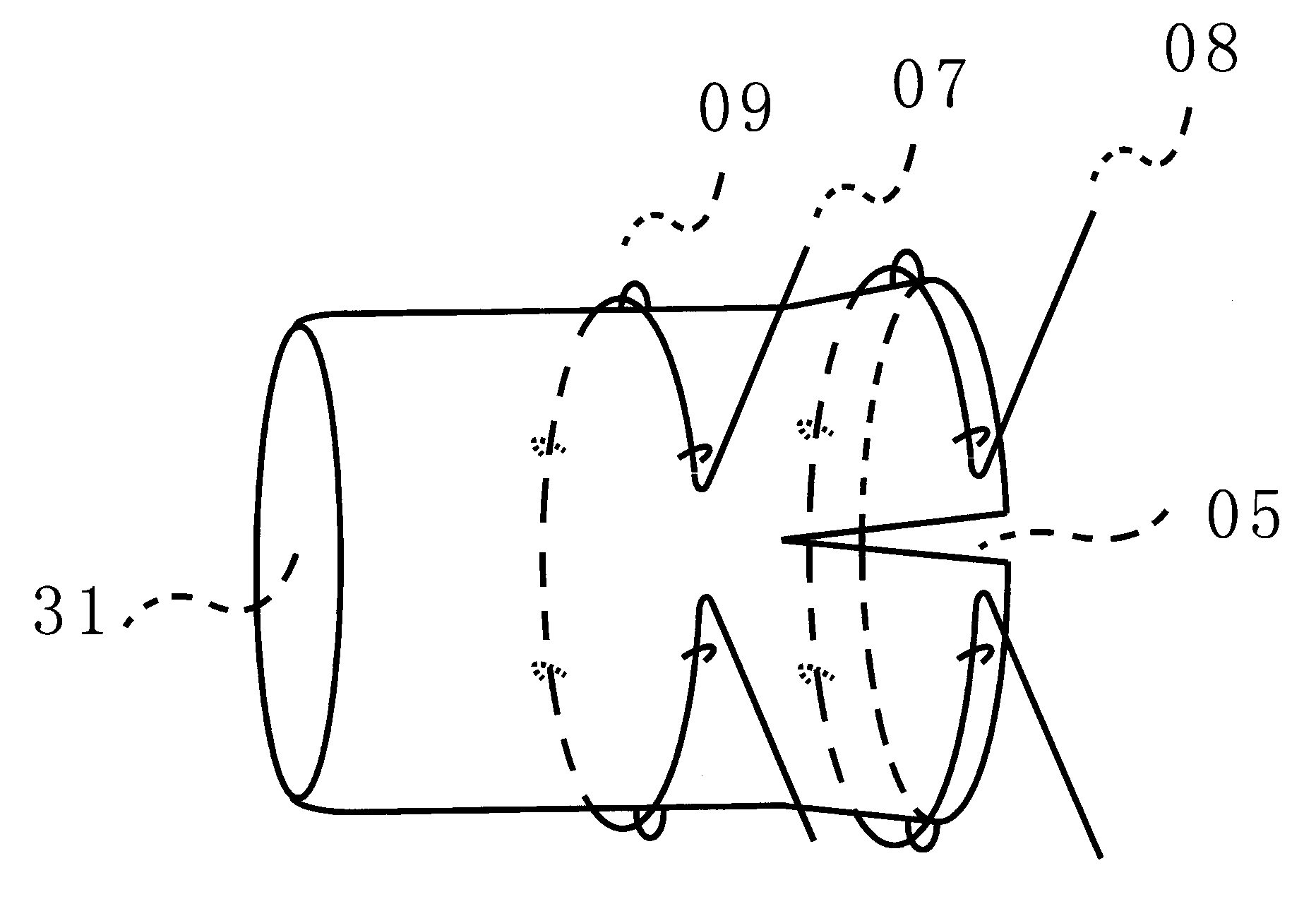 Oversleeve type aorta anastomosis device