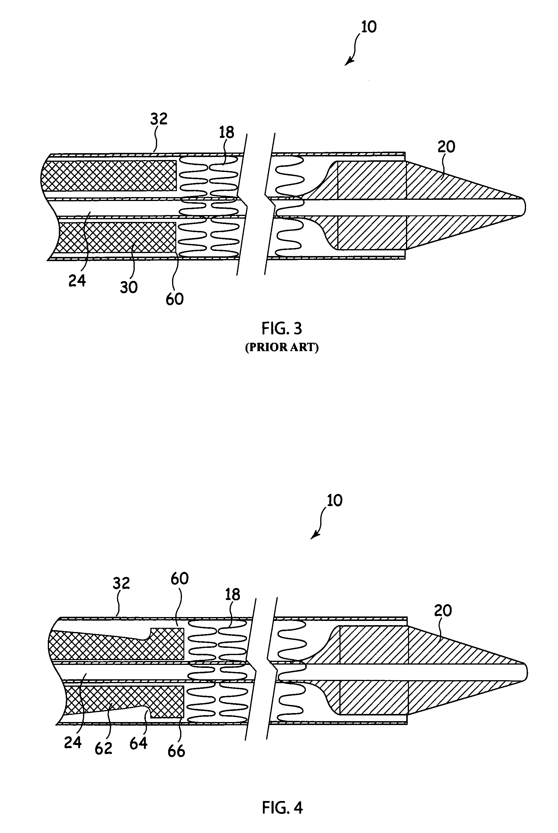 Pusher sheath and deployment device