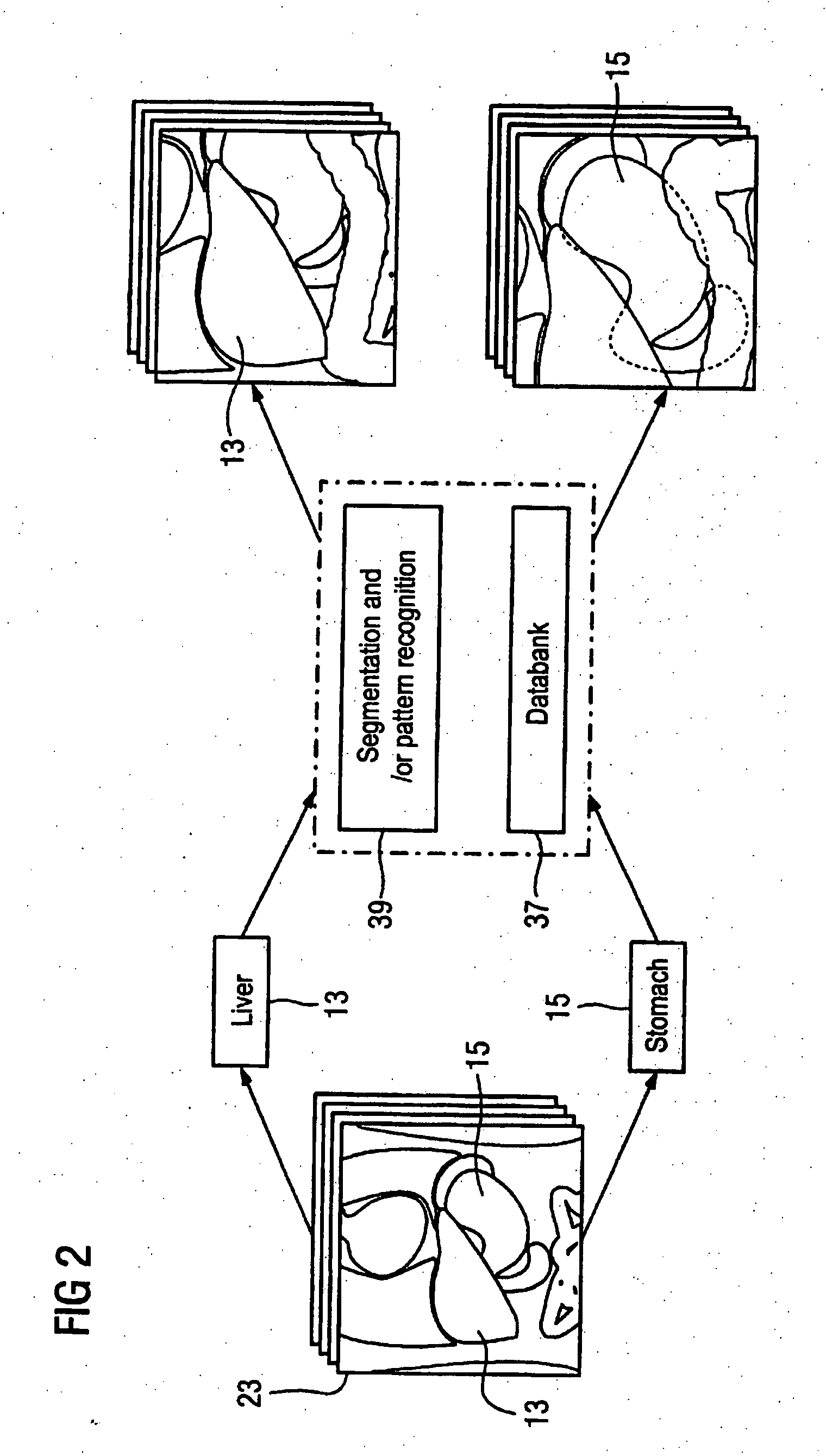 Method and processor for generating a medical image