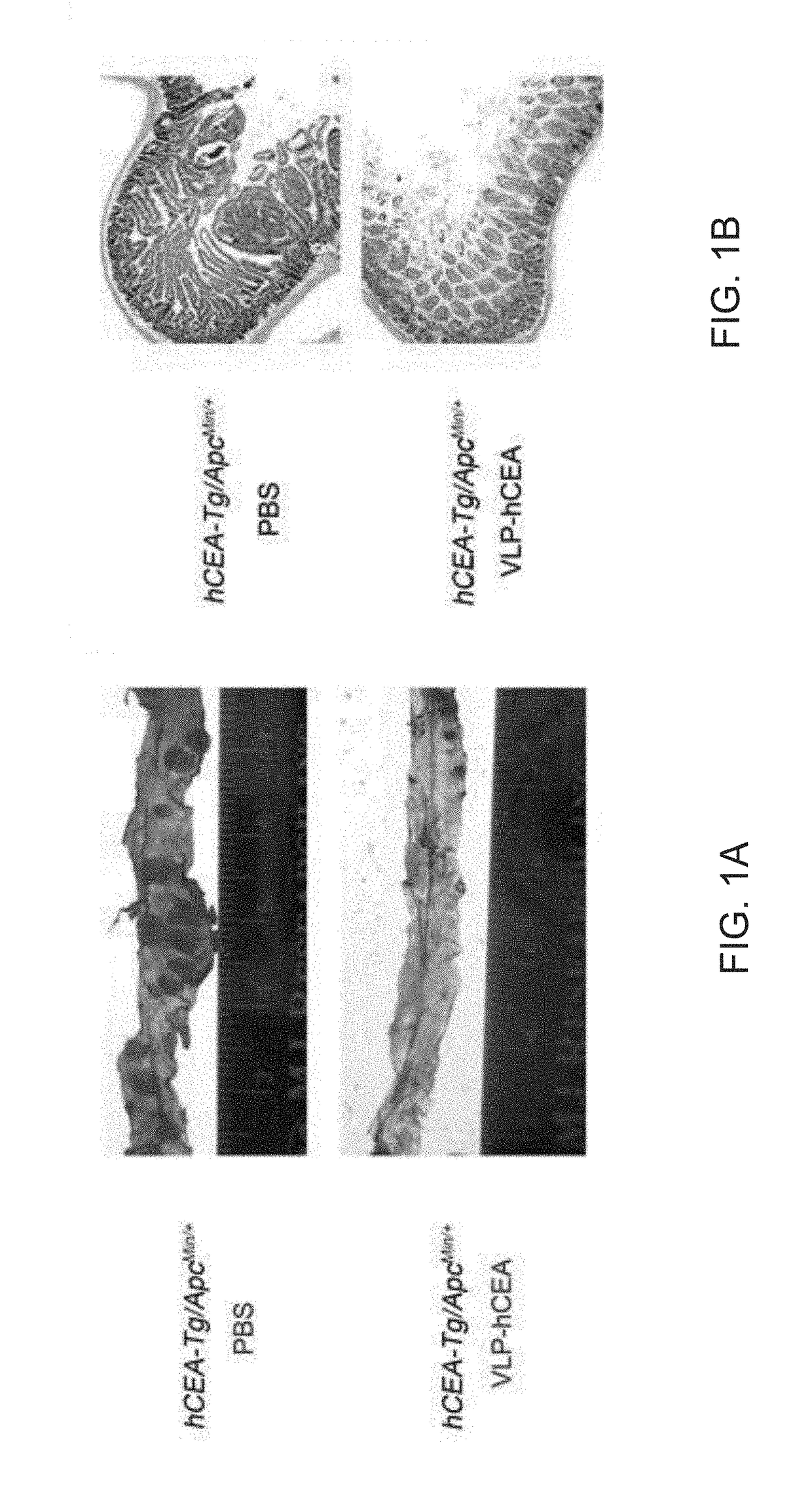 Inflammasome activators and methods of use to treat tumors