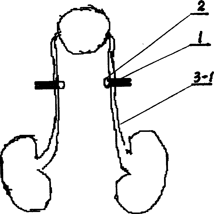 Obstructive nephroma animal model and its manufacturing method