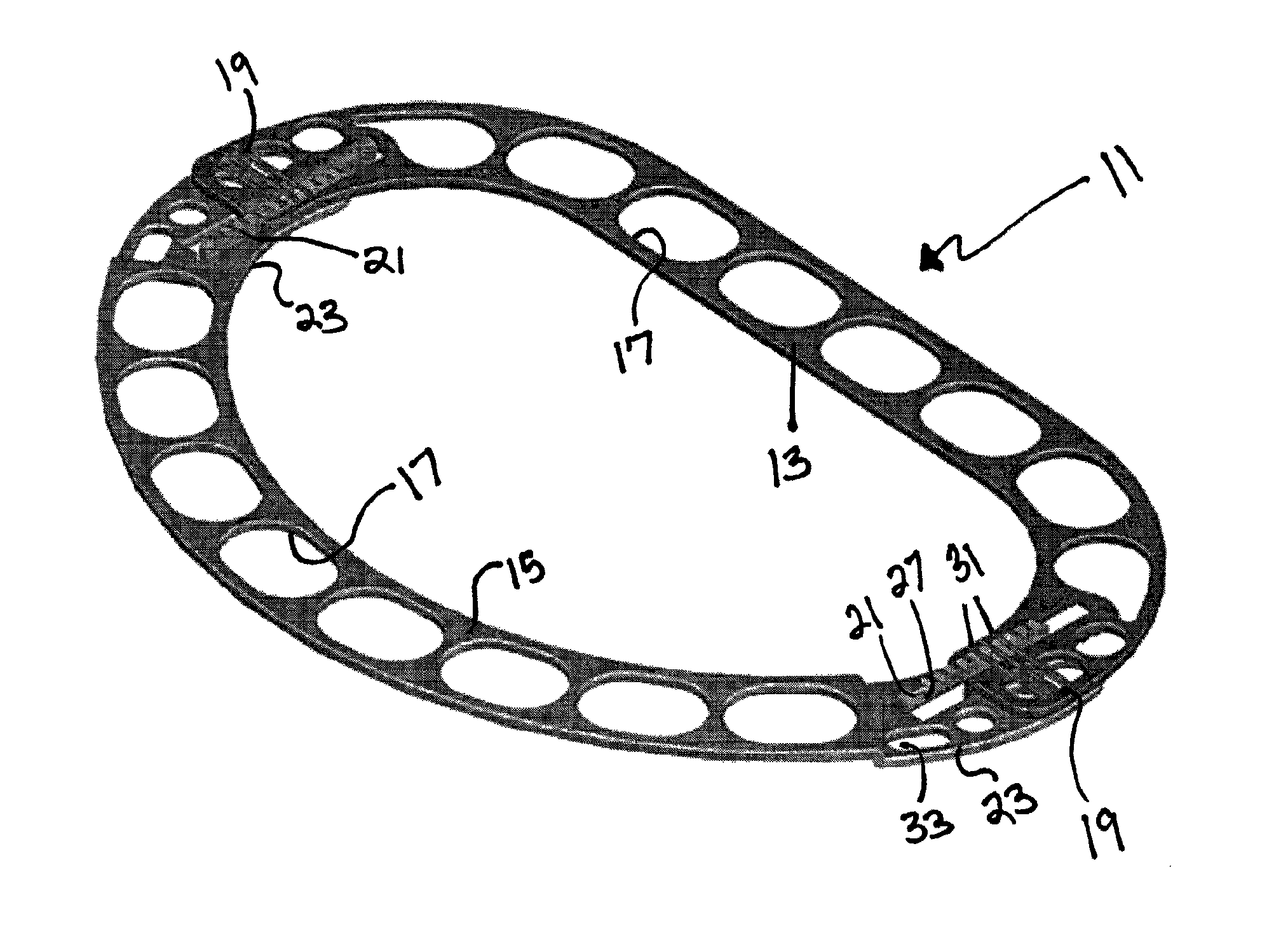 Adjustable annuloplasty rings