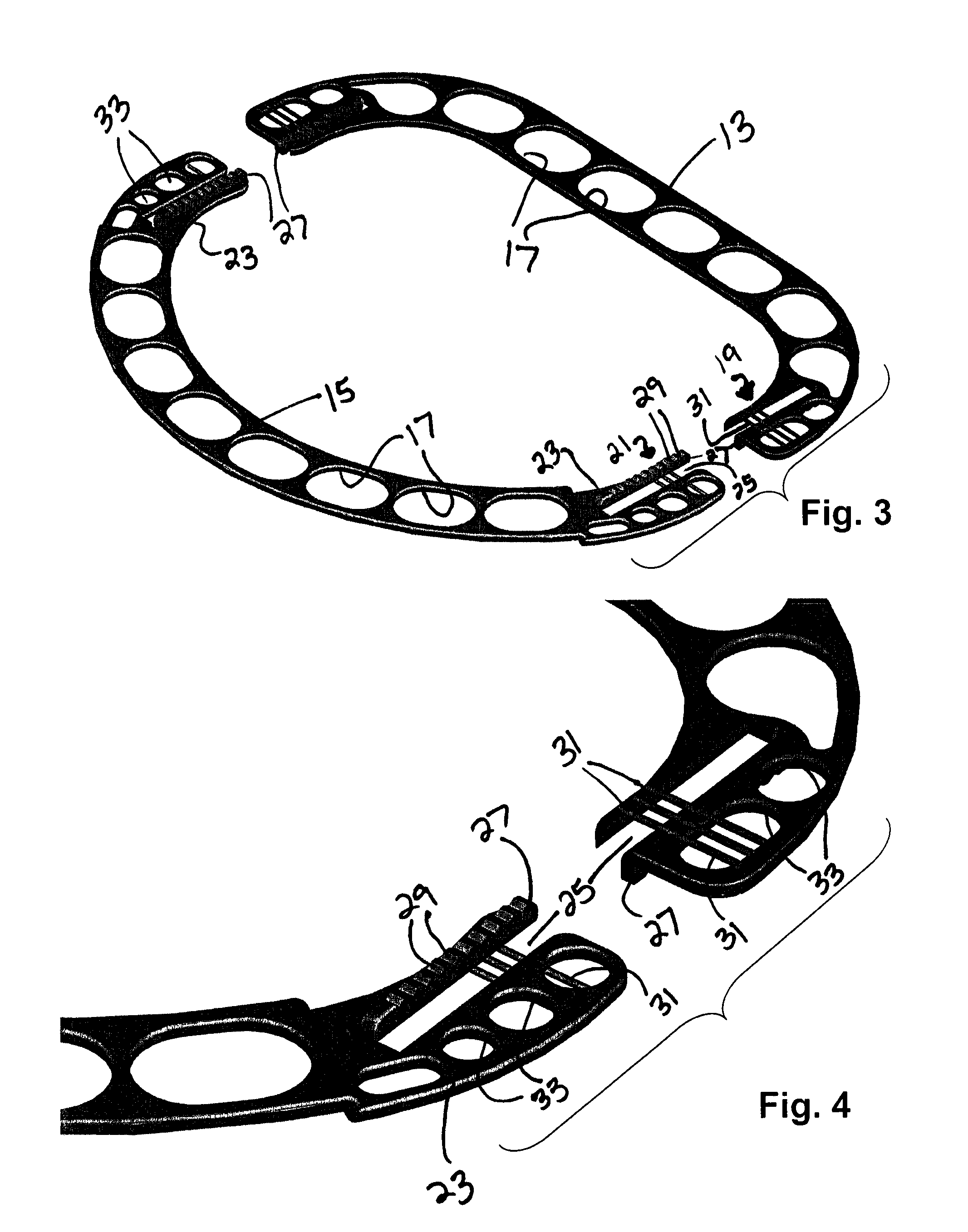 Adjustable annuloplasty rings