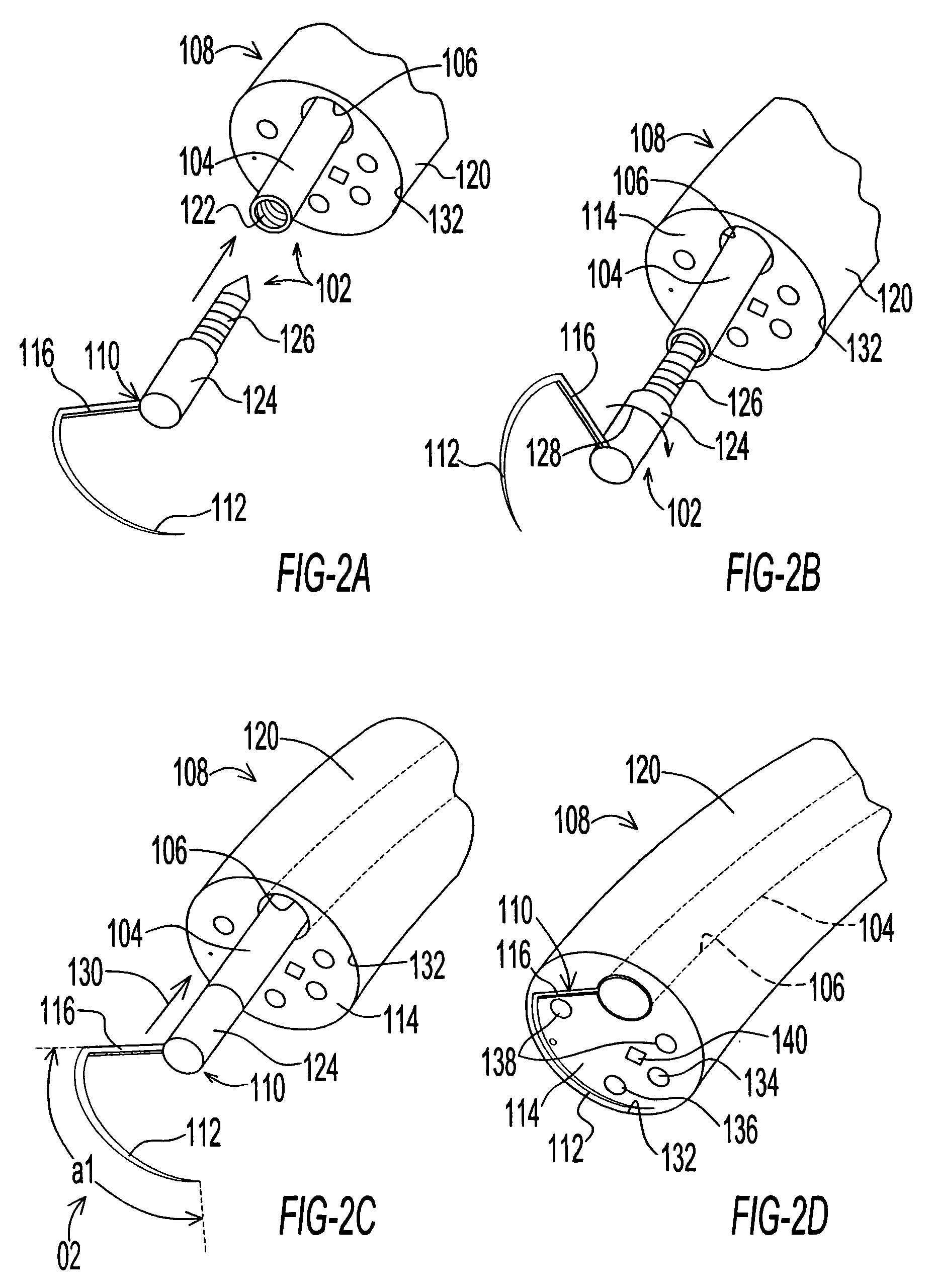 Endoscopic instrument assembly with separable operative tip and associated medical method