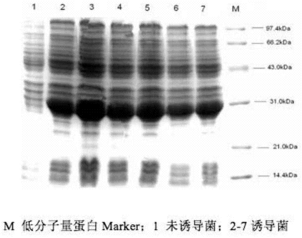 West nile virus monoclonal antibody and kit