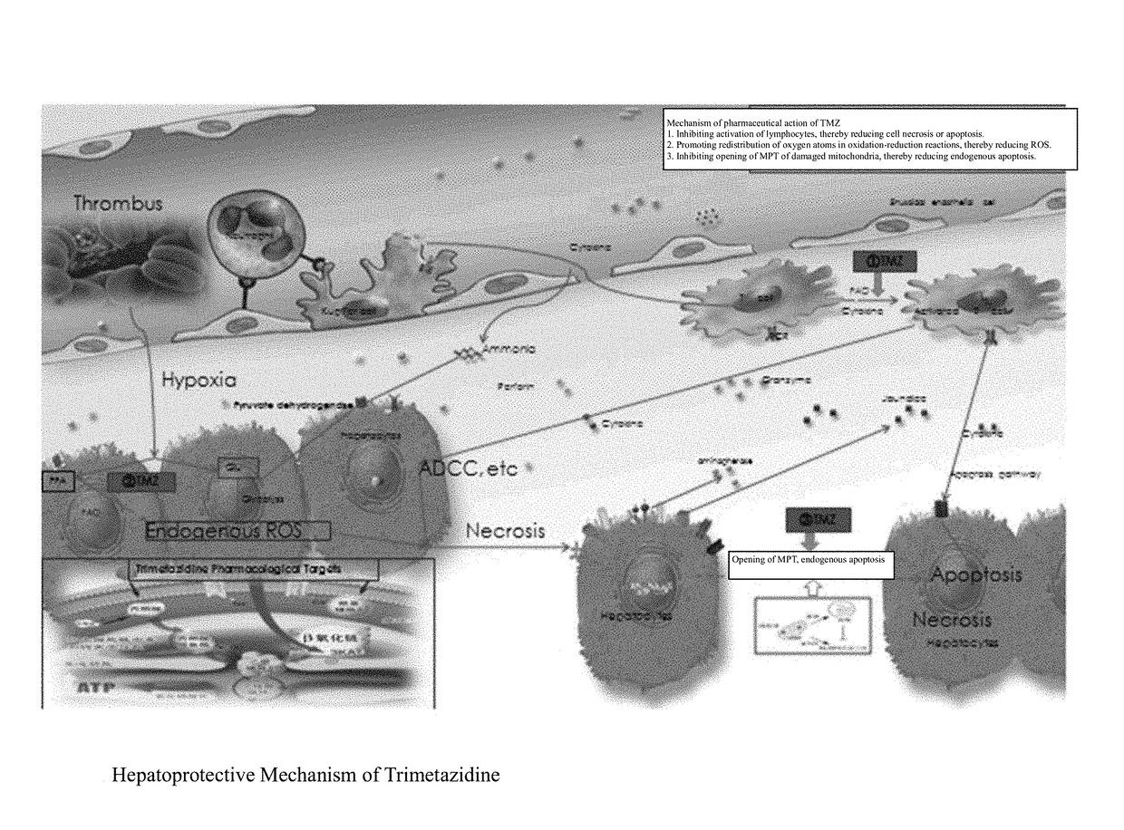 Use of trimethazine in preparation of drugs for preventing and treating liver diseases