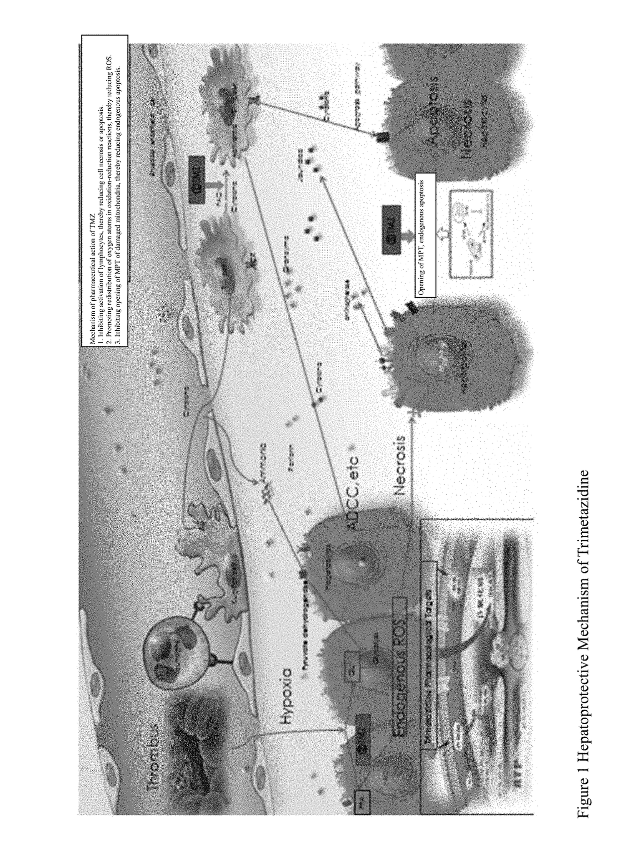 Use of trimethazine in preparation of drugs for preventing and treating liver diseases