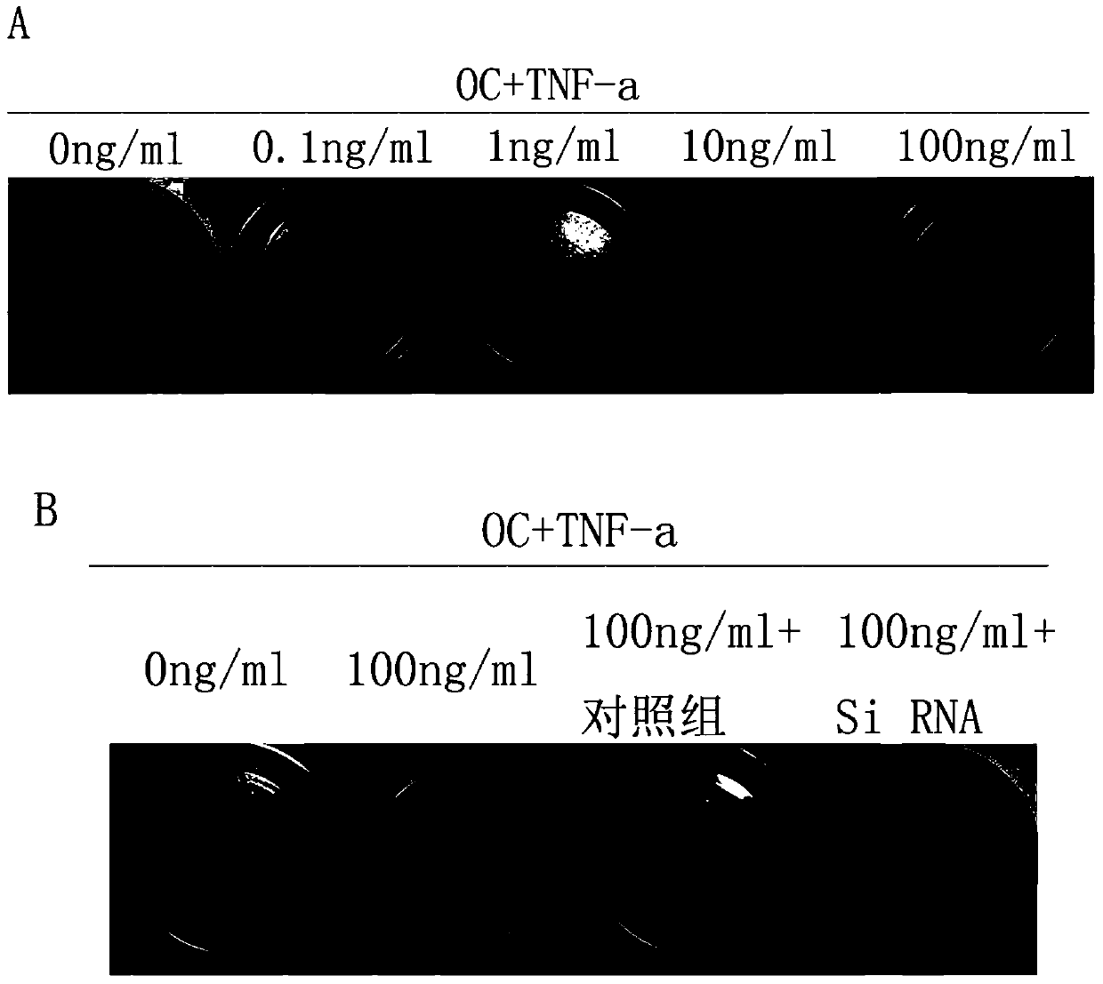 Small interfering RNA targeting human jnk1 gene and its application