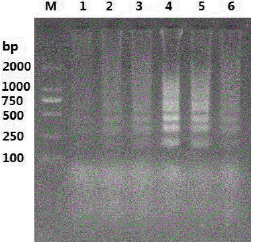 RT-LAMP (reverse transcription loop-mediated isothermal amplification) detection method for transmissible gastroenteritis of swine TGE