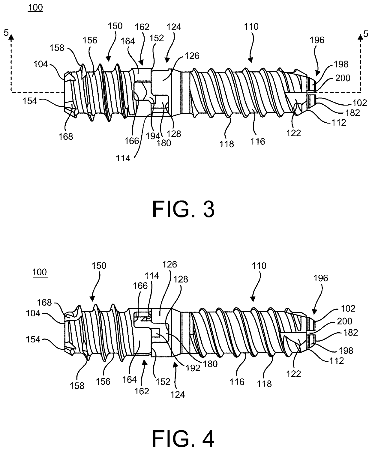 Implants and methods of use and assembly