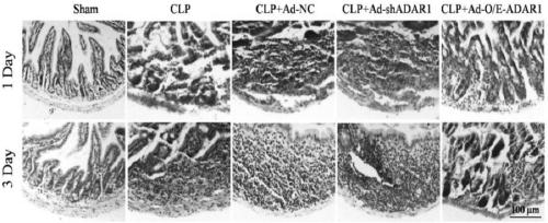 ADAR1 (Adenosine Deaminases Acting on RNA1) over-expressed virus vector as well as construction method and application thereof