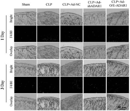 ADAR1 (Adenosine Deaminases Acting on RNA1) over-expressed virus vector as well as construction method and application thereof