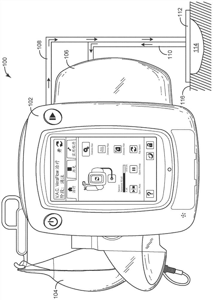 Wound therapy system with wound volume estimation