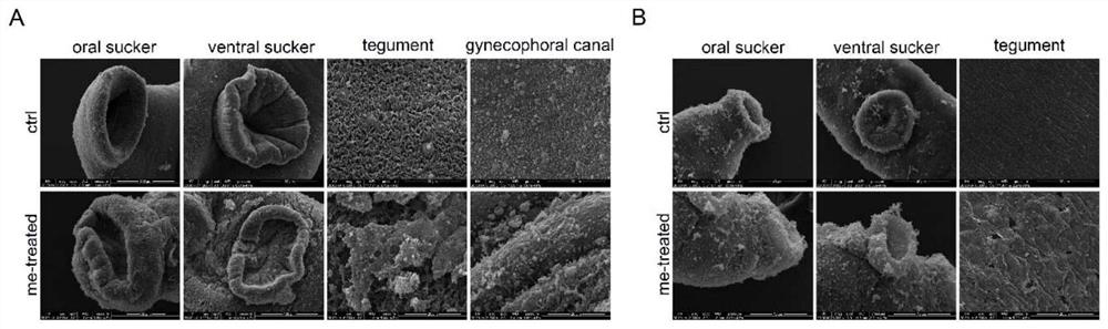 Application of myricetin in preparation of drug for treating schistosomiasis