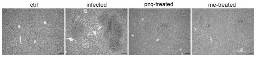 Application of myricetin in preparation of drug for treating schistosomiasis