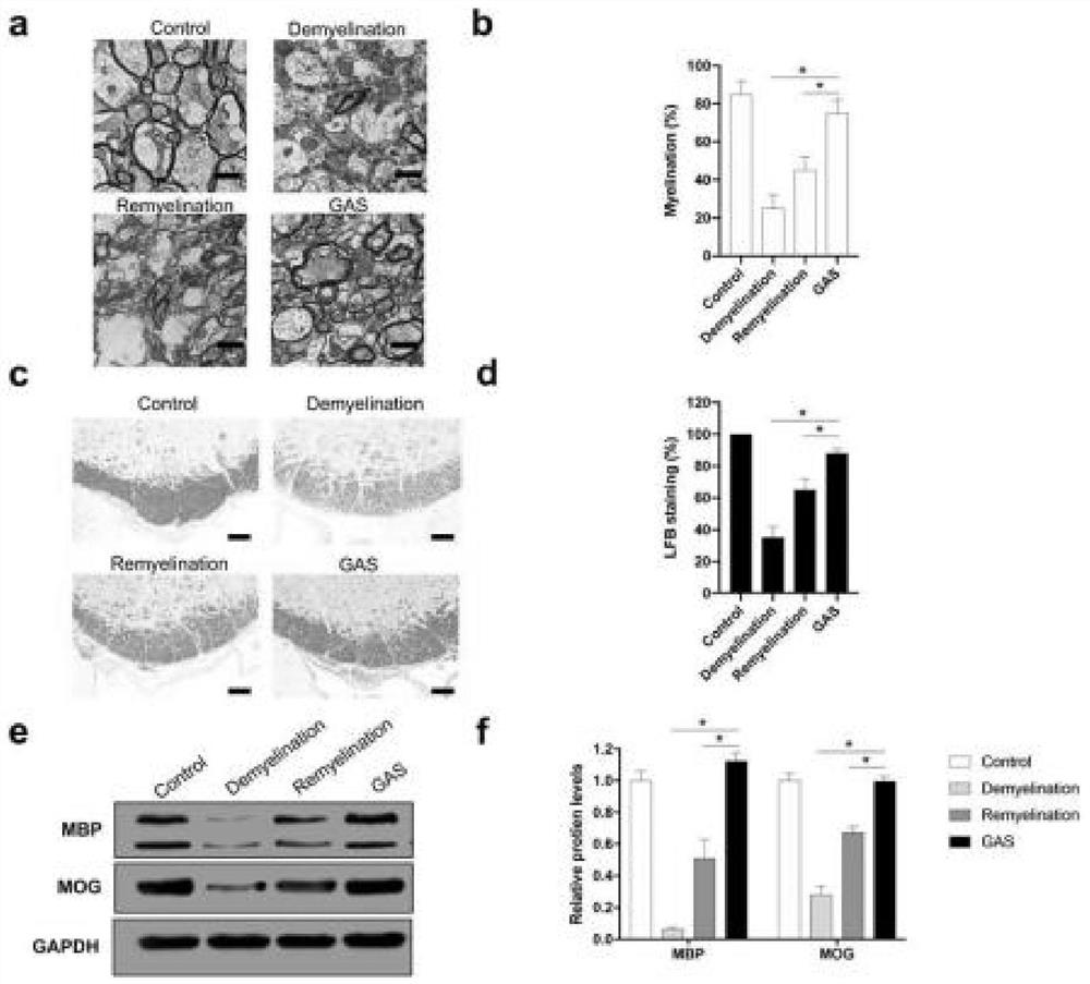 A kind of measuring method of gm7237 to central nervous myelinization