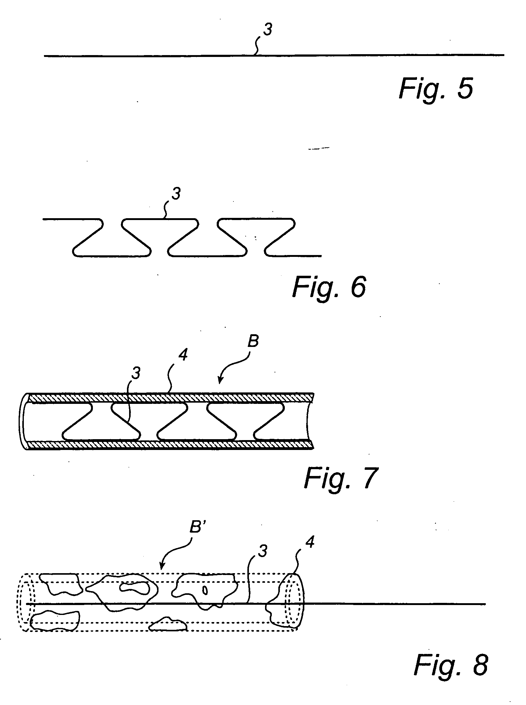 Delayed memory device