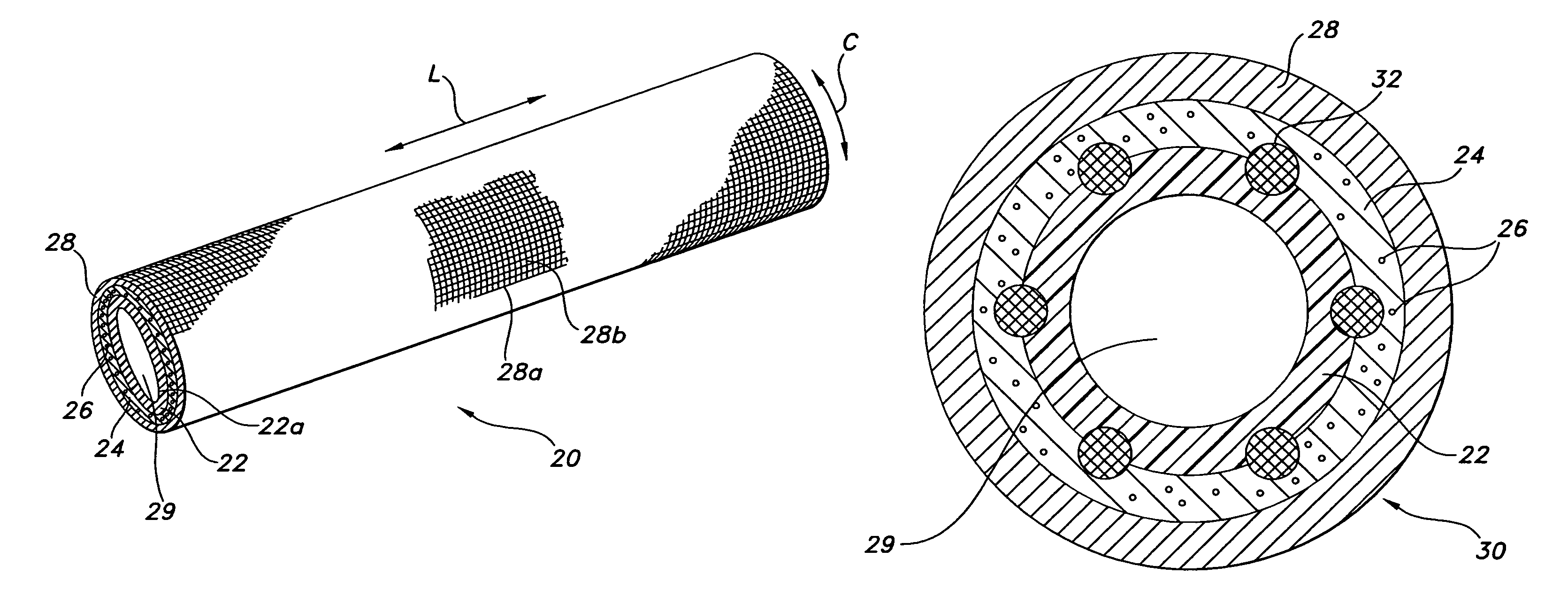 Implantable medical devices with antimicrobial and biodegradable matrices