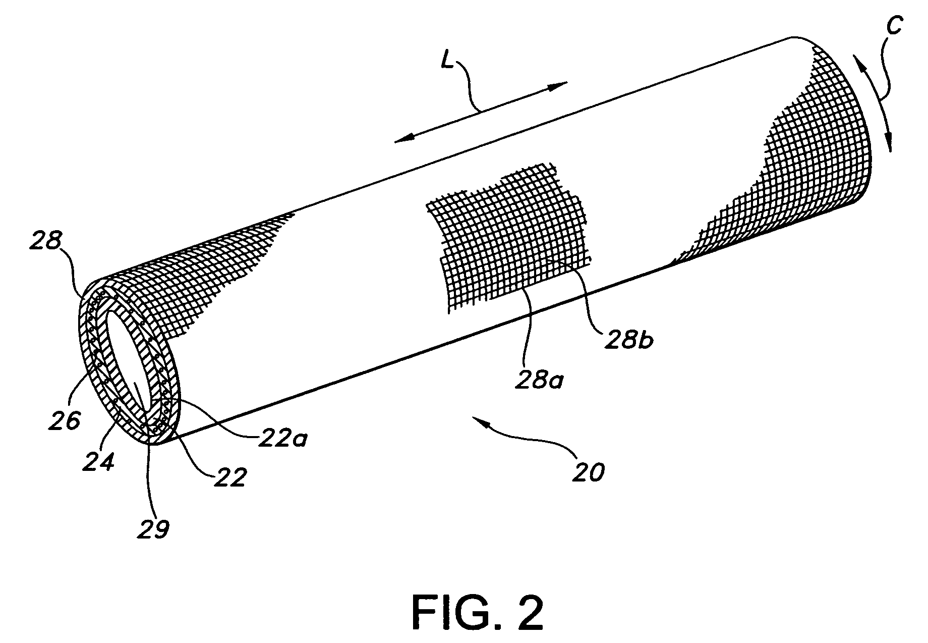 Implantable medical devices with antimicrobial and biodegradable matrices